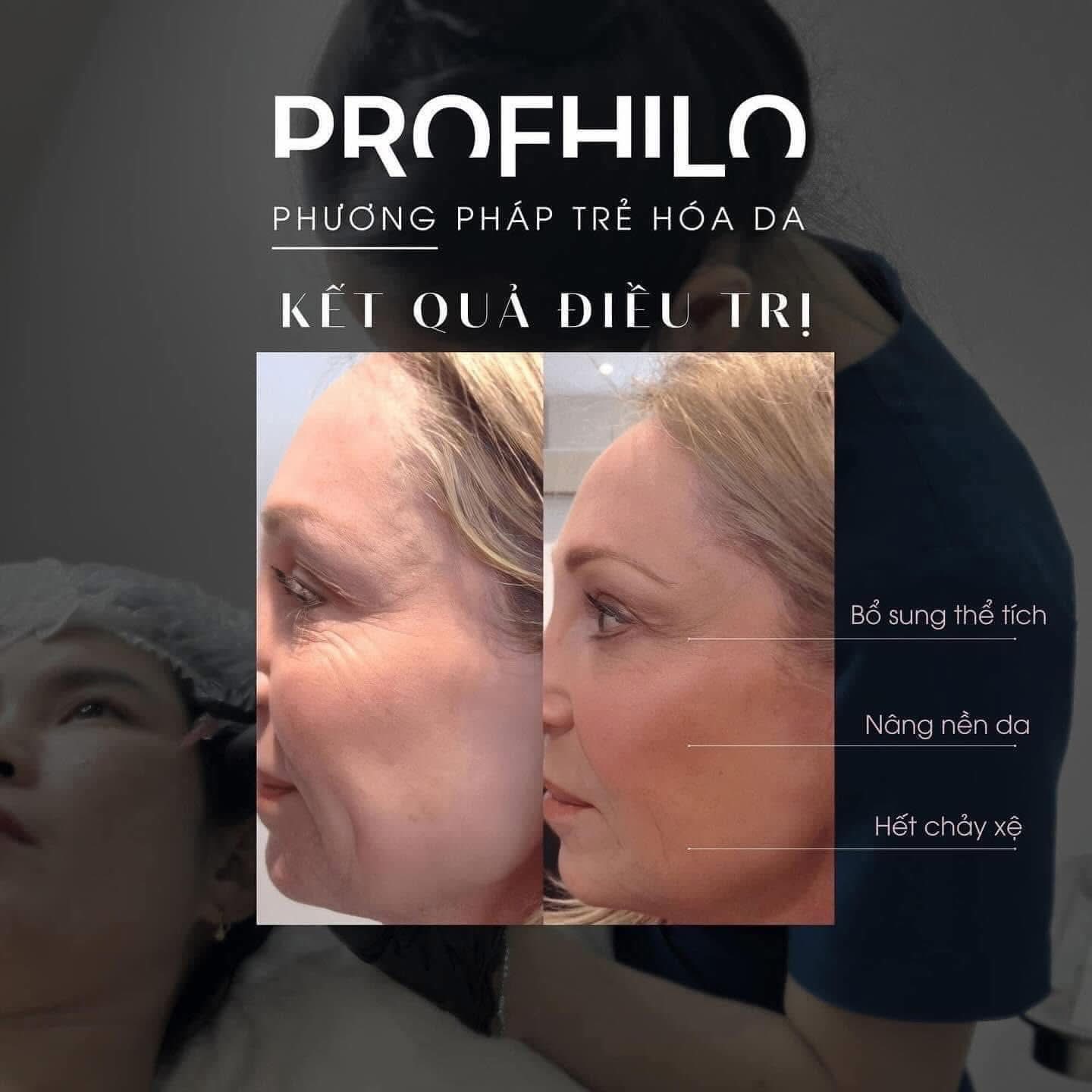 Liệu Trình Tiêm BAP Profhilo: Tinh Chất Trẻ Hóa Và Nâng Cơ Toàn Diện Chuẩn Y Khoa
