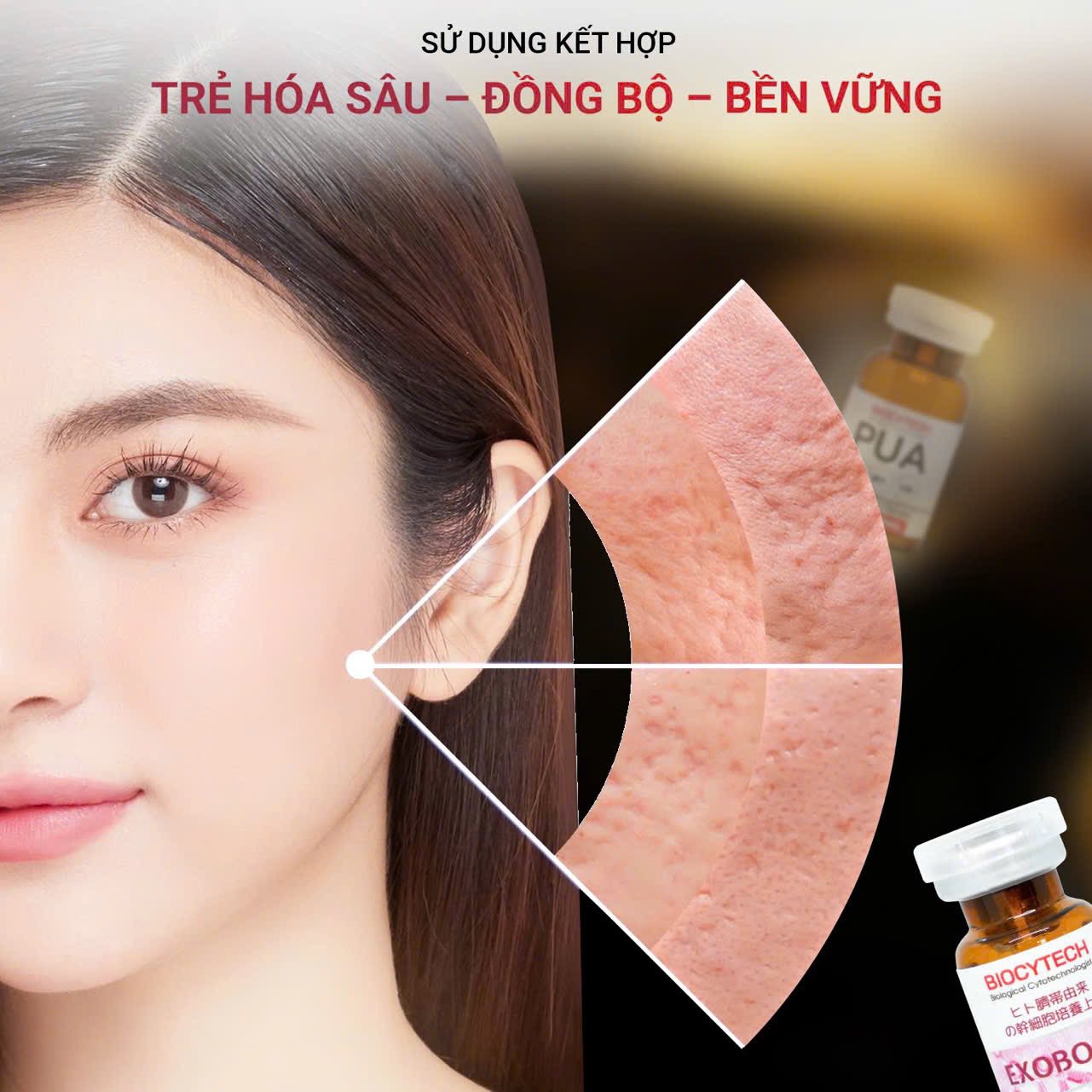 Liệu pháp tế bào phục hồi, trẻ hóa da Biocytech EXOBOOST