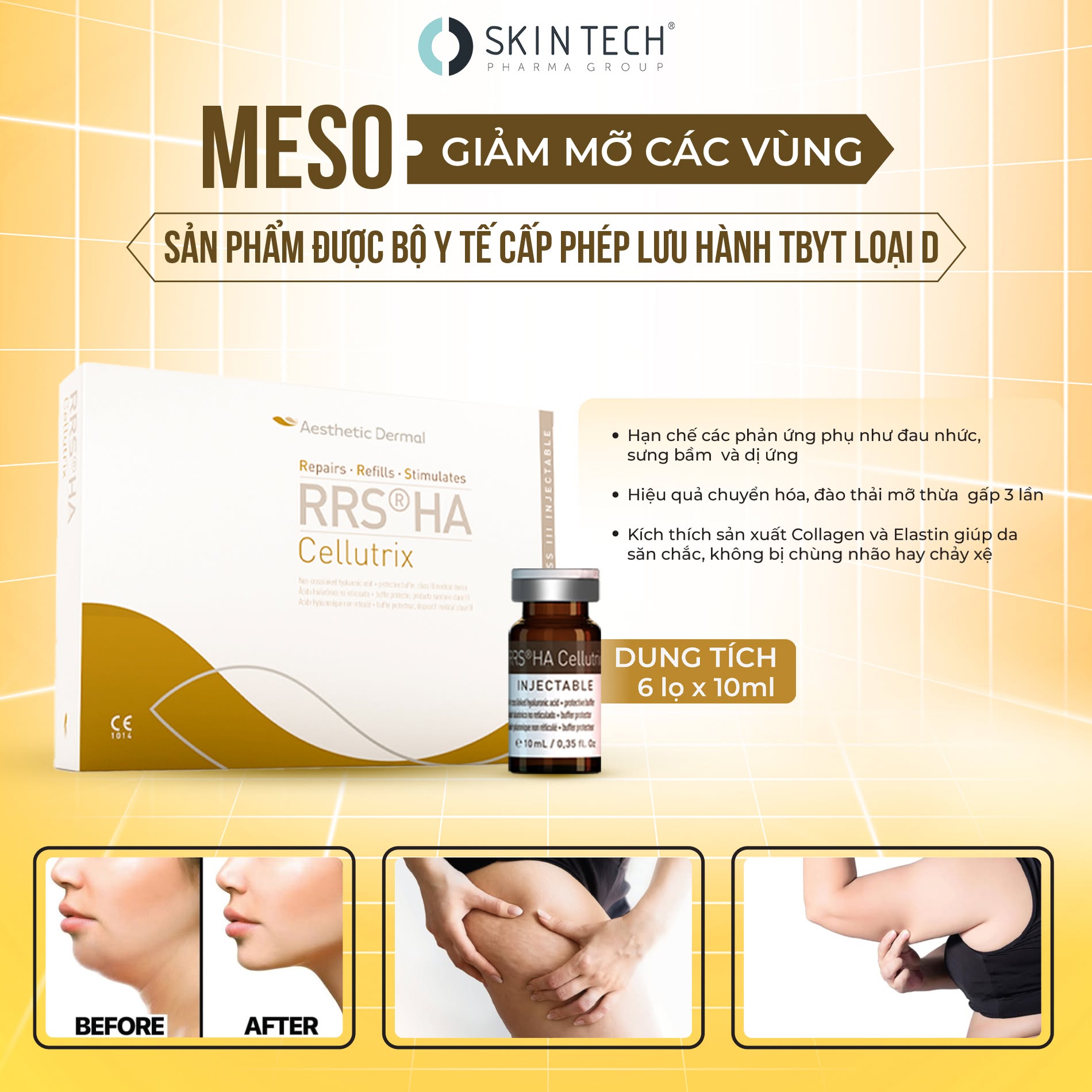 MESO GIẢM MỠ RRS® HA CELLUTRIX SKIN TECH 10ML- Lẻ 1 lọ