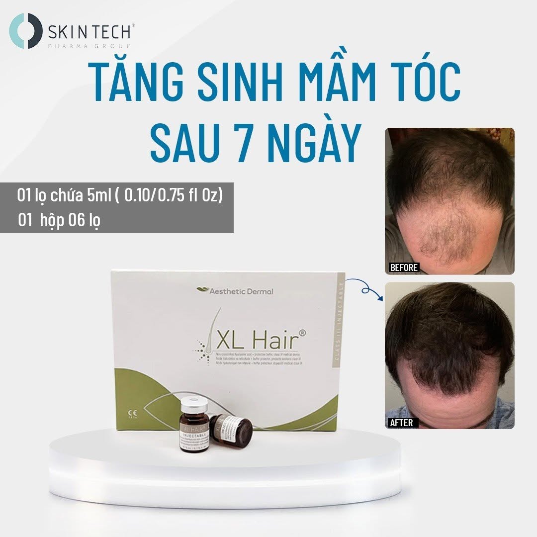 MESO KÍCH THÍCH MỌC TÓC XL HAIR SKIN TECH 5ML