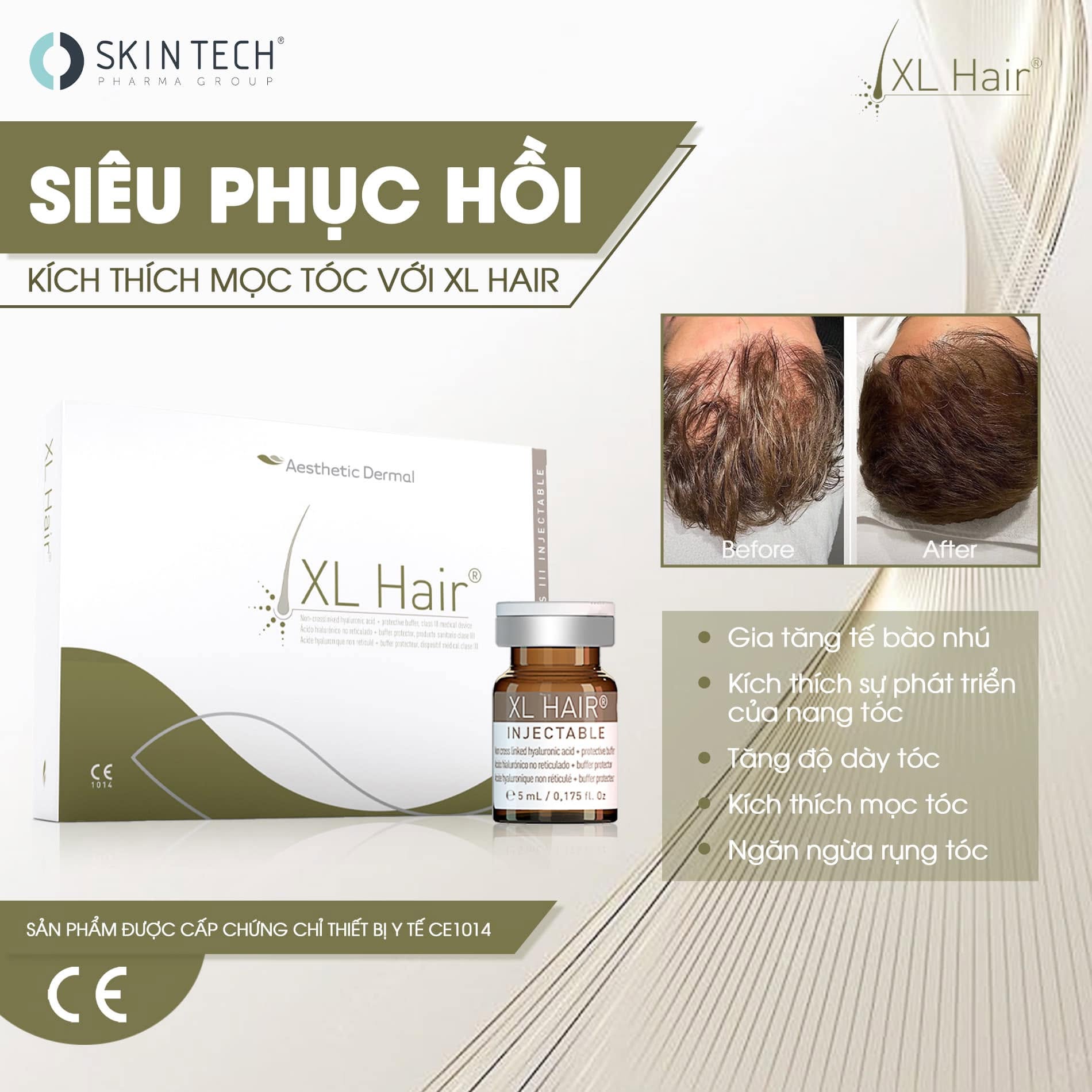 MESO KÍCH THÍCH MỌC TÓC XL HAIR SKIN TECH 5ML