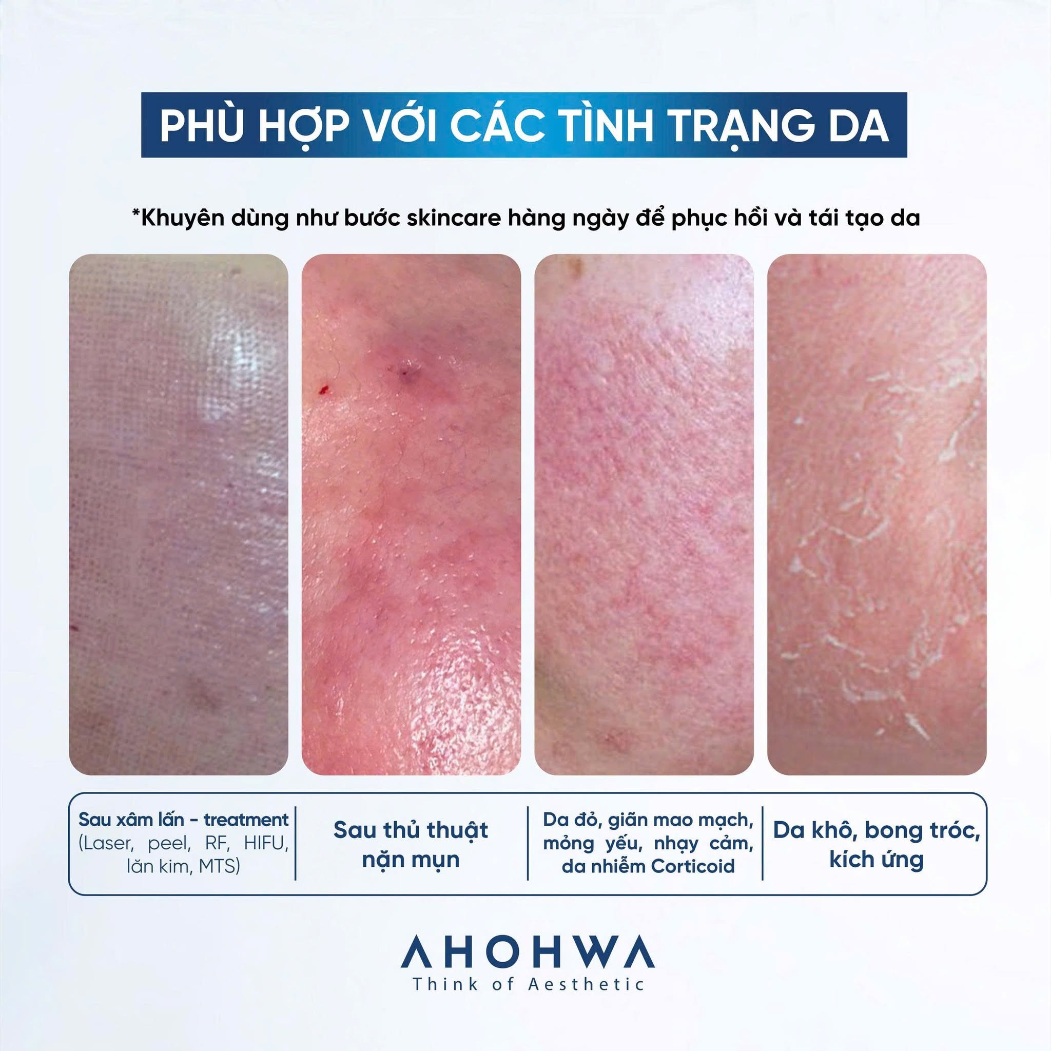 Mặt nạ giấy sinh học phục hồi vitamin K Ahohwa Vitamin K Calming Sheet Mask