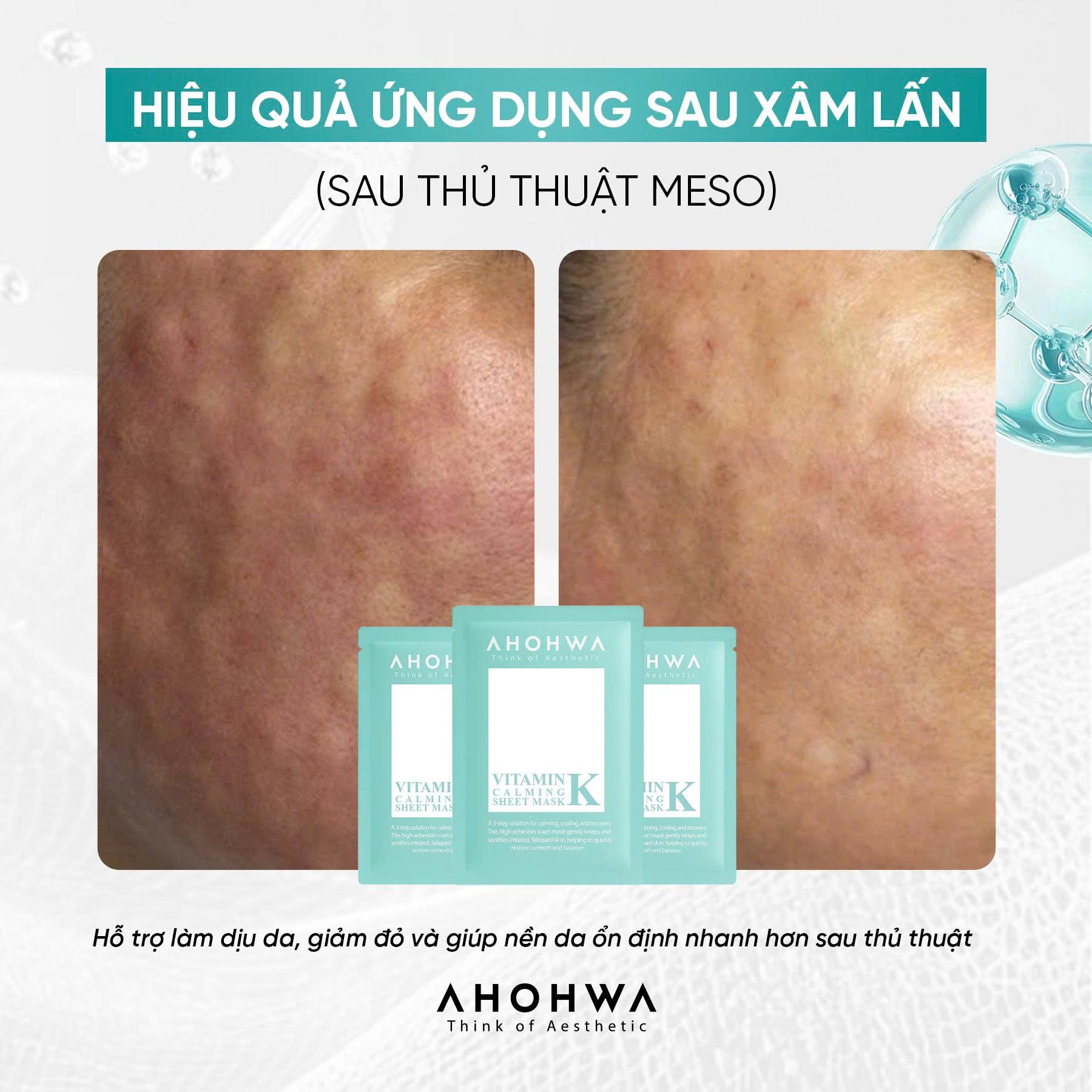 Mặt nạ giấy sinh học phục hồi vitamin K Ahohwa Vitamin K Calming Sheet Mask