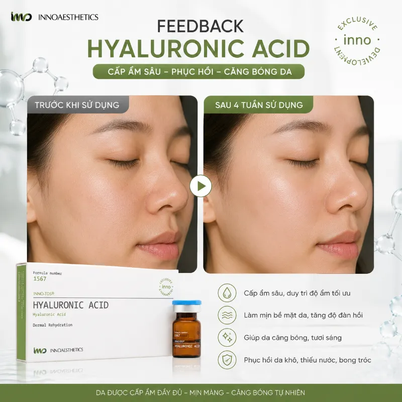 Meso Innoaesthetics Hyaluronic Acid – Hoạt Chất Cấp Ẩm, Làm Đầy Và Căng Bóng Da 2.5ml