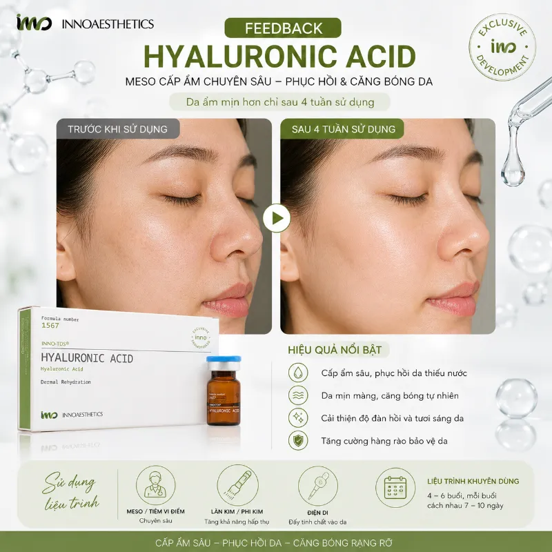 Meso Innoaesthetics Hyaluronic Acid – Hoạt Chất Cấp Ẩm, Làm Đầy Và Căng Bóng Da 2.5ml