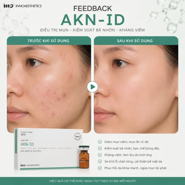 Meso hỗ trợ cải thiện mụn, ngăn ngừa tổn thương do mụn Innoaesthetics AKN-ID