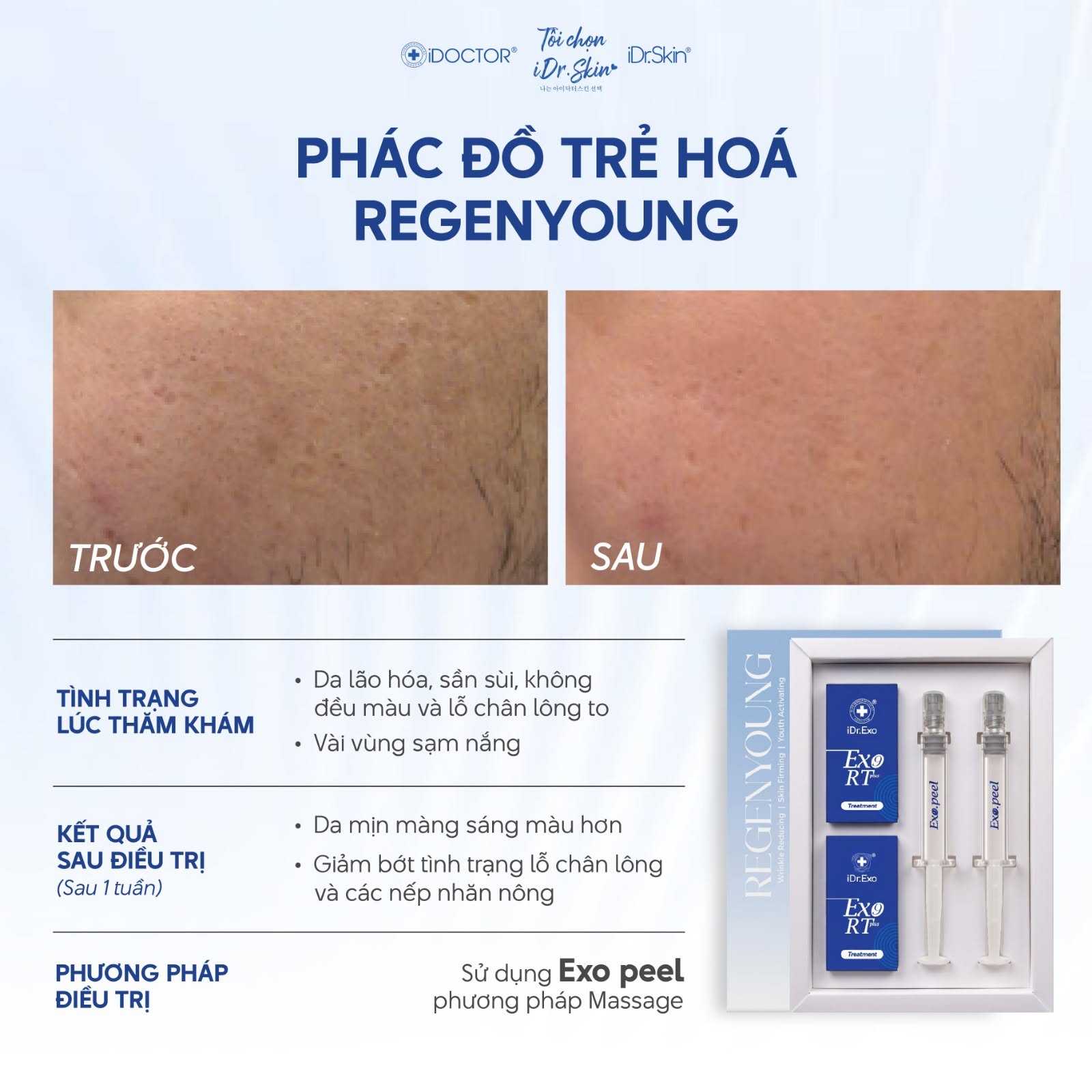 Peel Vật Lý Căng Bóng Da iDr.Skin iDr.Exo Peel Chính Hãng