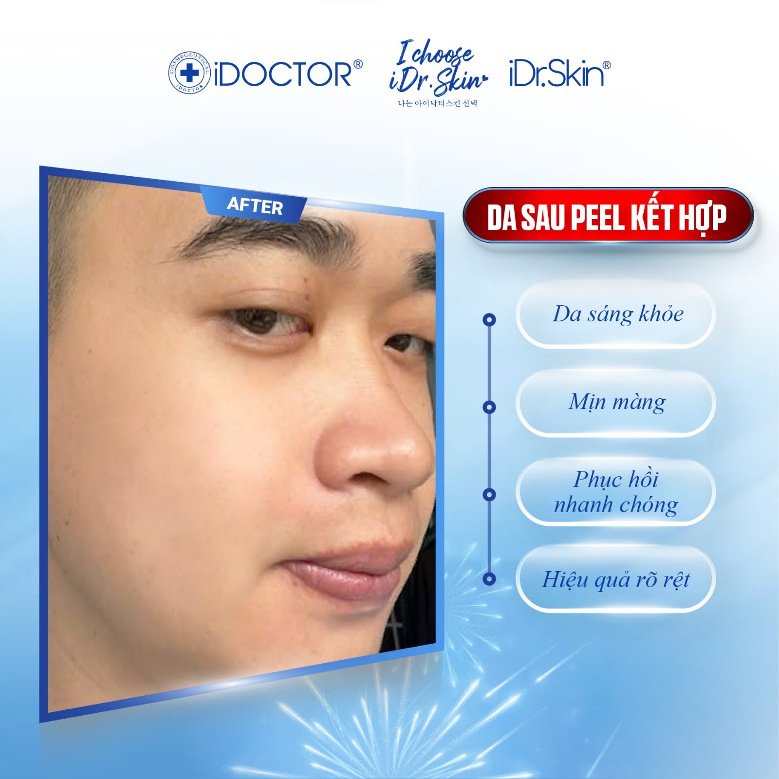 Peel Vật Lý Căng Bóng Da iDr.Skin iDr.Exo Peel Chính Hãng