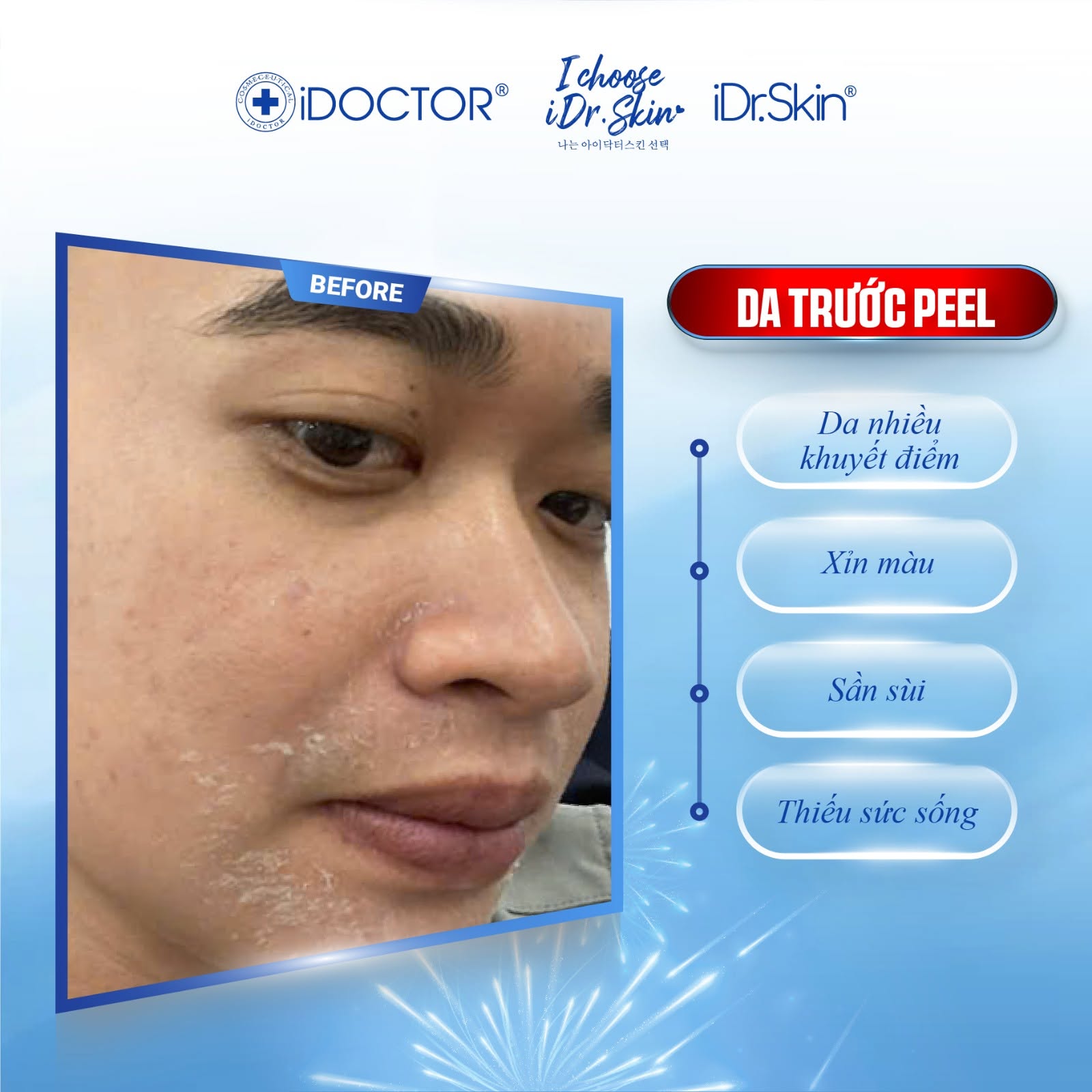 Peel Vật Lý Căng Bóng Da iDr.Skin iDr.Exo Peel Chính Hãng
