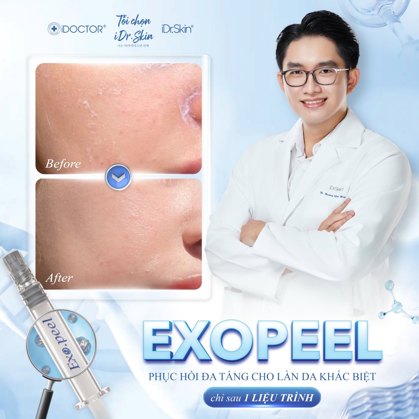 Peel Vật Lý Căng Bóng Da iDr.Skin iDr.Exo Peel Chính Hãng