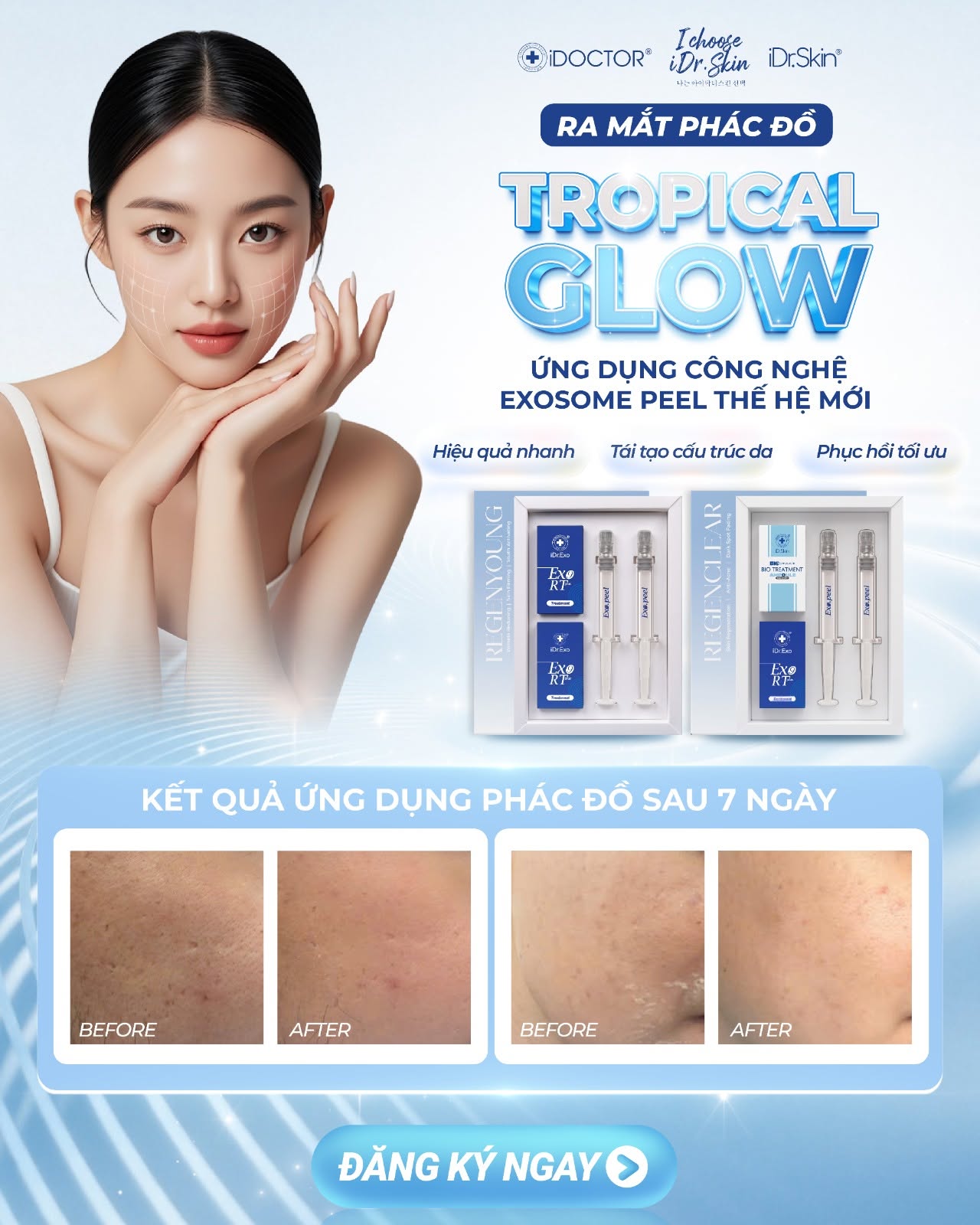 Peel Vật Lý Căng Bóng Da iDr.Skin iDr.Exo Peel Chính Hãng
