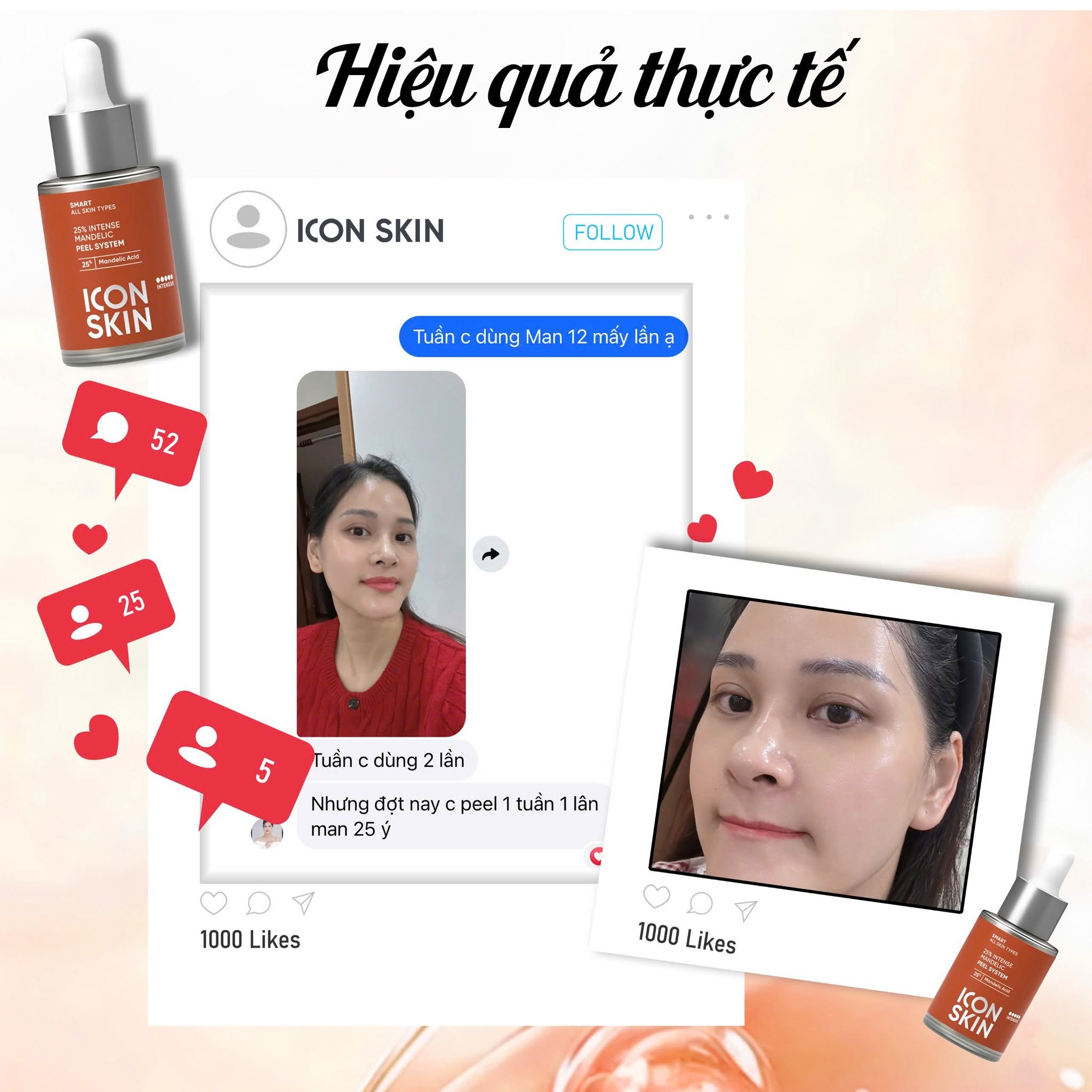 Peel phục hồi tông màu, độ đàn hồi da Icon Skin 25% Intense Mandelic Peel System
