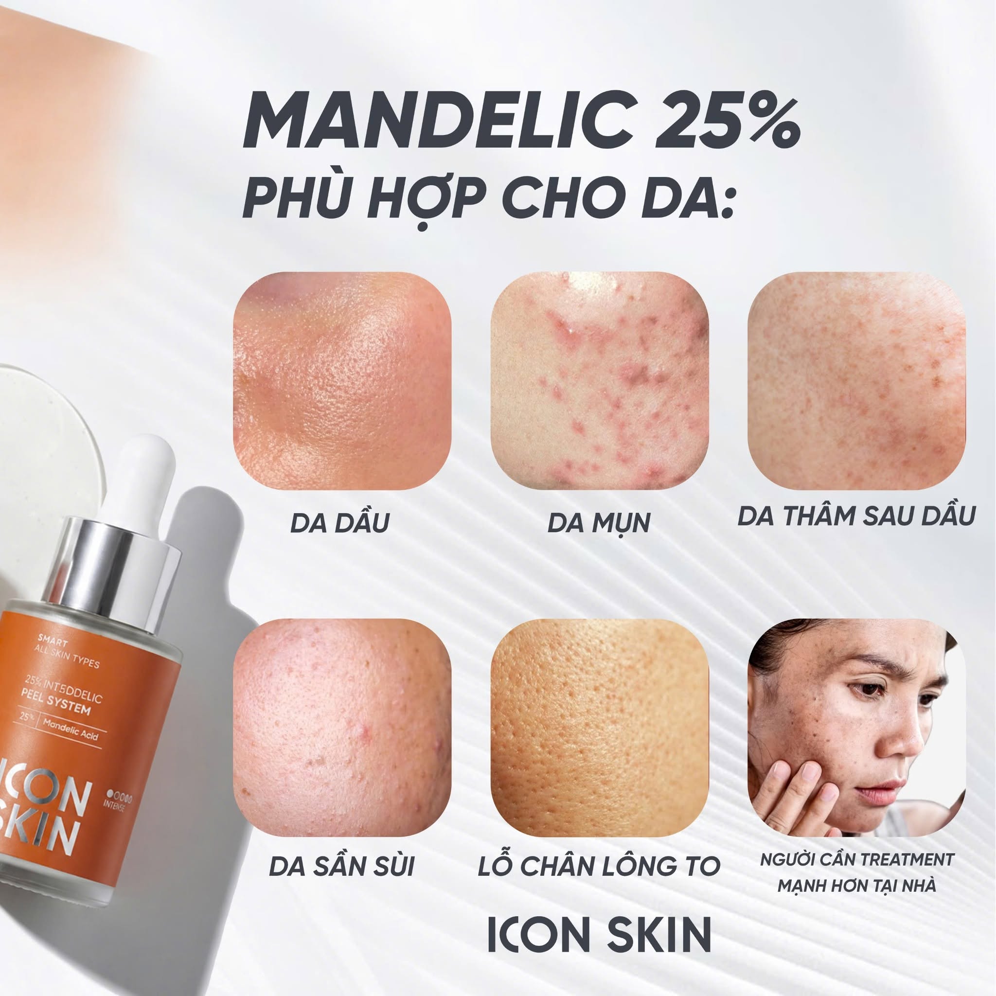 Peel phục hồi tông màu, độ đàn hồi da Icon Skin 25% Intense Mandelic Peel System