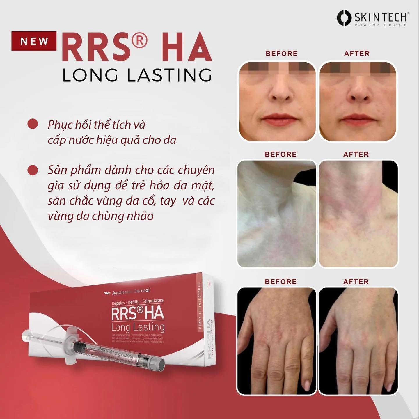 SkinTech RRS HA Long Lasting – Hoạt Chất HA Liên Kết Chéo Nâng Cơ Và Trẻ Hóa Da