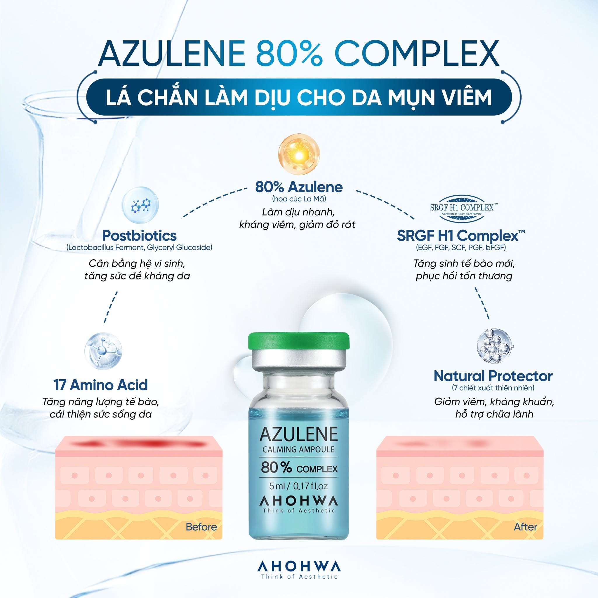 Tế bào gốc kháng viêm phục hồi tái tạo da mụn Ahohwa Azulene Calming Ampoule 80%
