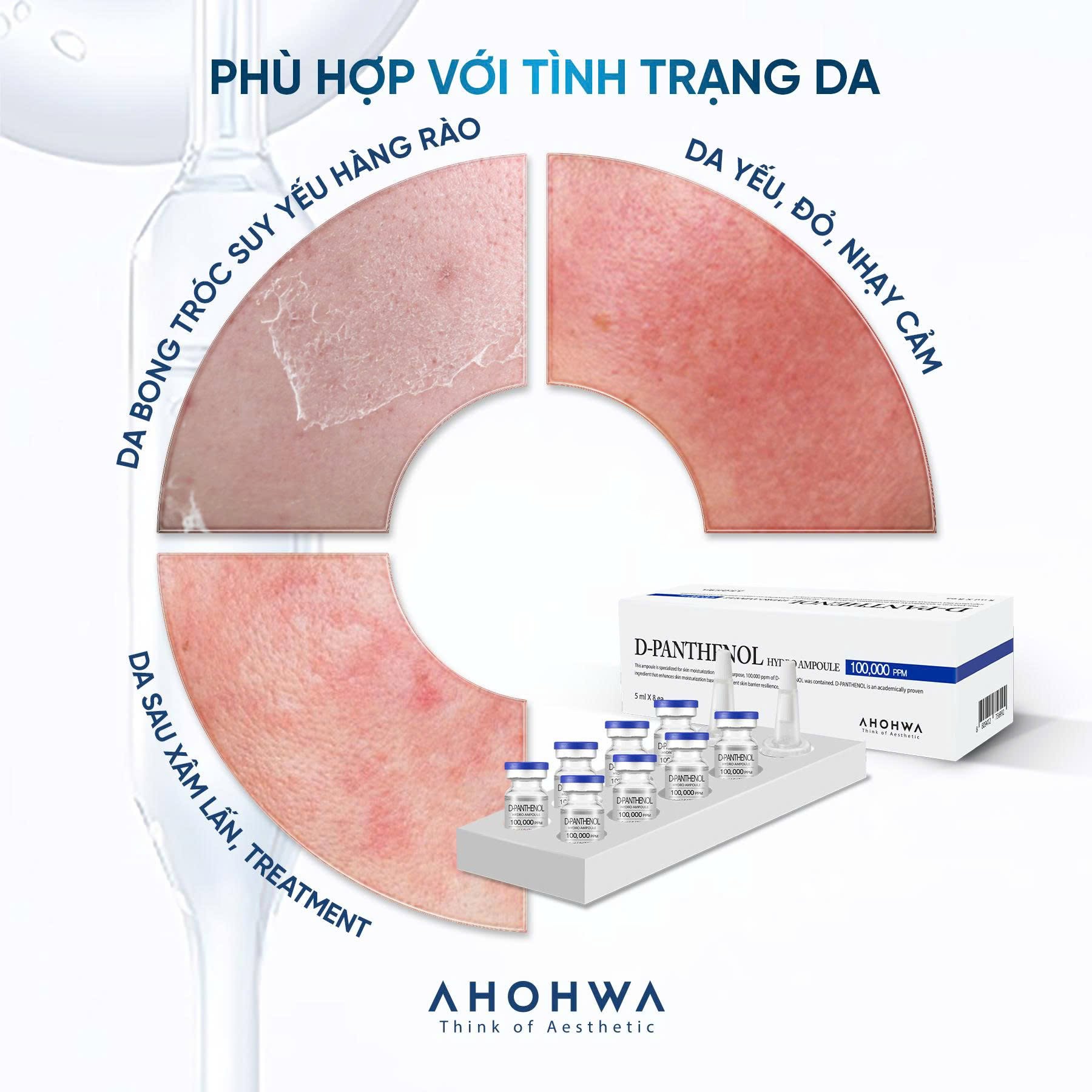 Tế bào gốc kháng viêm phục hồi tái tạo da nhạy cảm sau xâm lấn Ahohwa D-Panthenol Hydro Ampoule