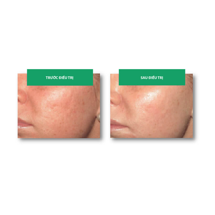 Tinh Chất Phục Hồi Da MD:Ceuticals MD:Cocktail Anti-Pollution Defence Chính Hãng