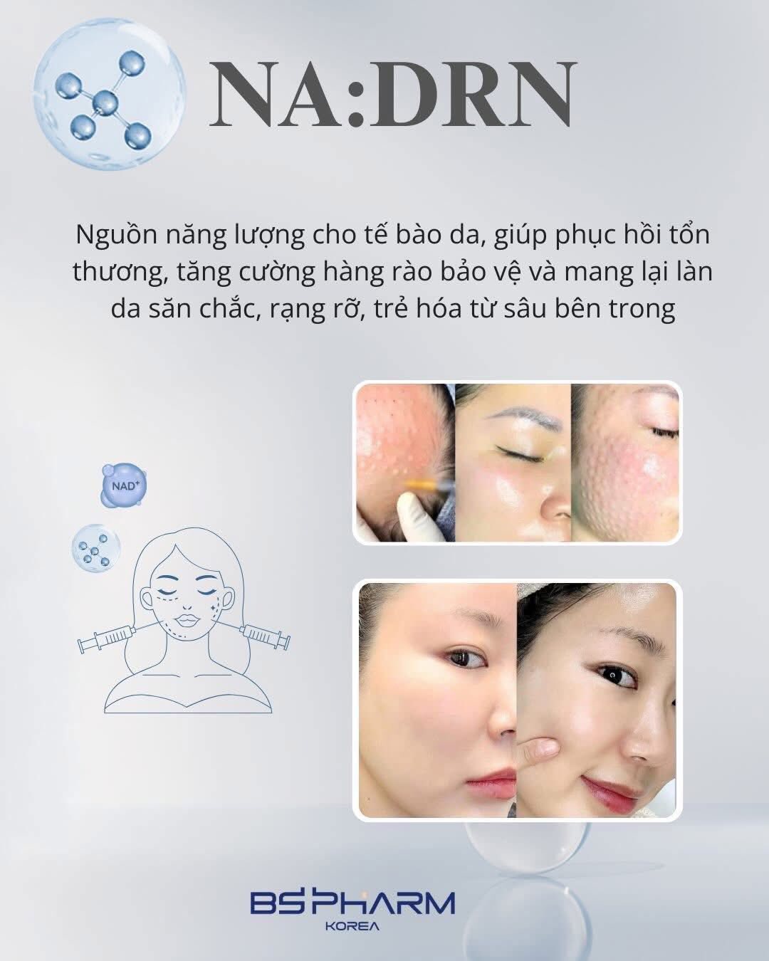Tinh Chất Tiêm Trẻ Hóa NA:DRN: Chuẩn Mực Tái Tạo Da Sinh Học Từ Hệ Kép NAD+ Và PDRN