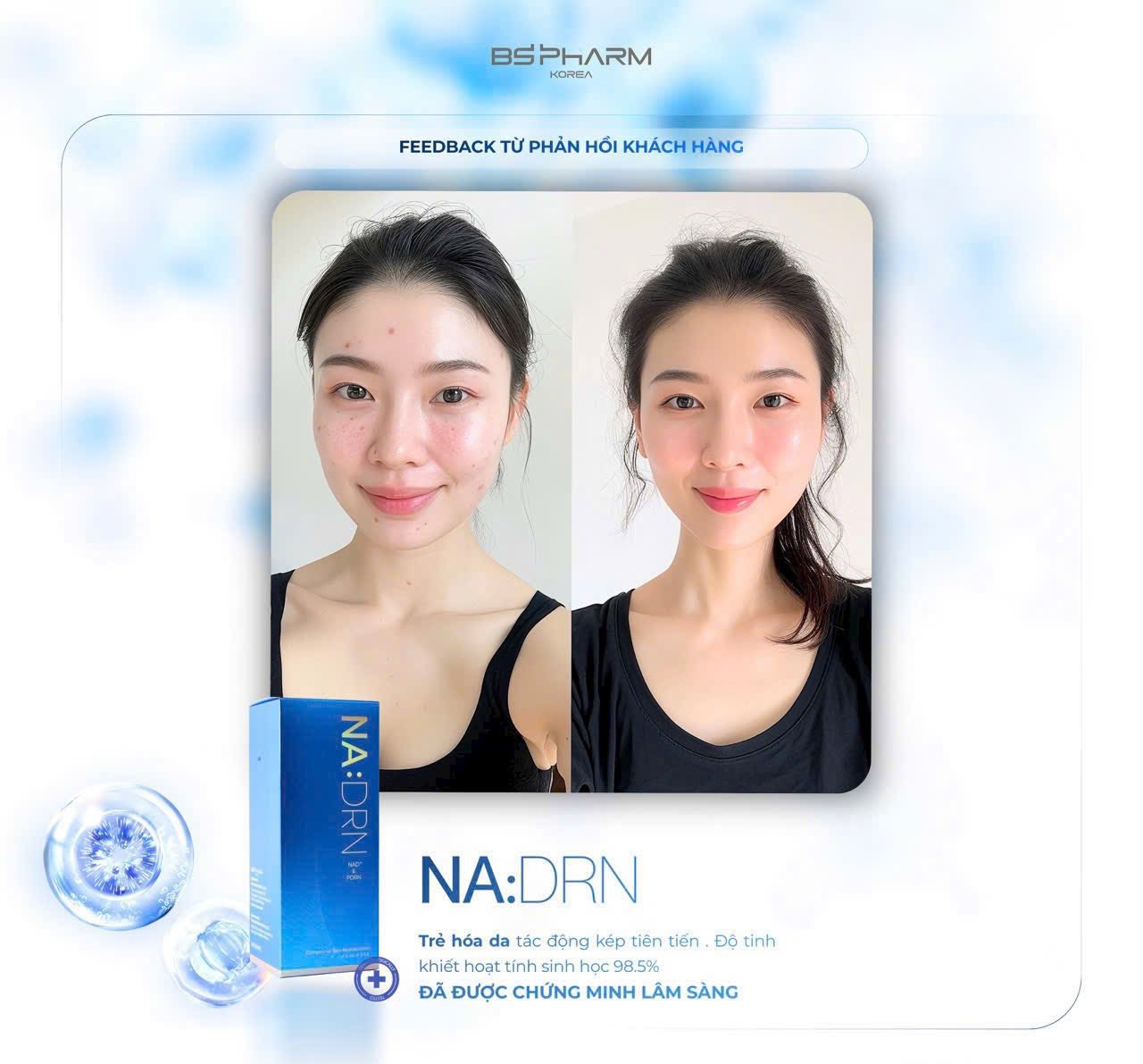 Tinh Chất Tiêm Trẻ Hóa NA:DRN: Chuẩn Mực Tái Tạo Da Sinh Học Từ Hệ Kép NAD+ Và PDRN