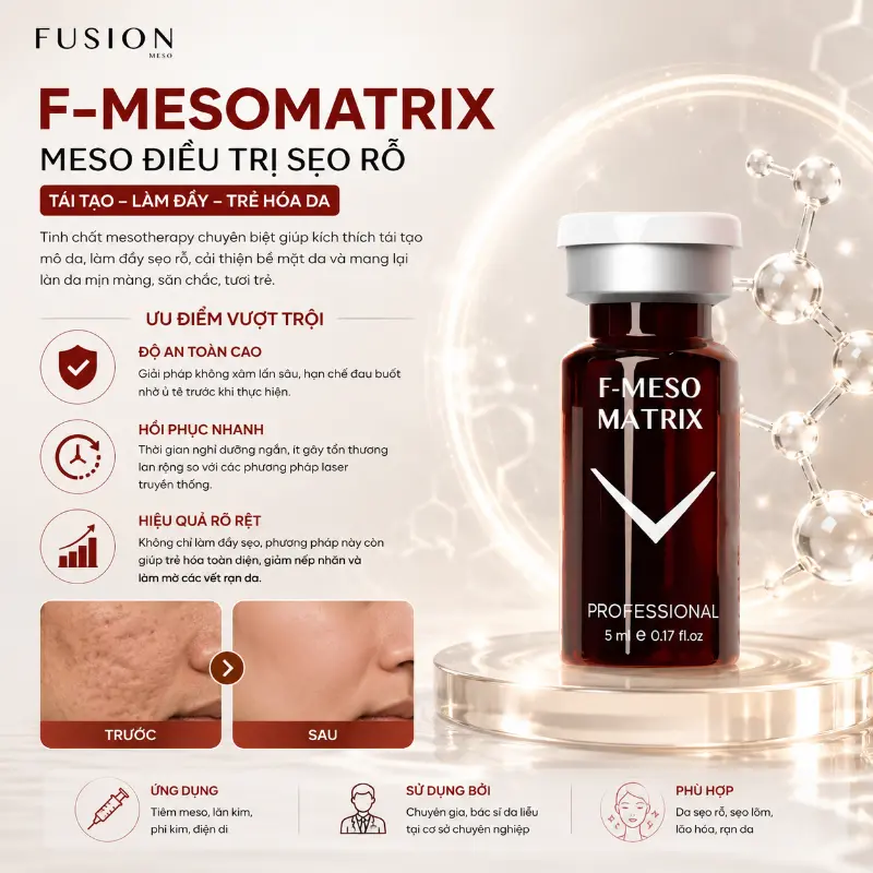 Tinh chất Fusion F-Meso Matrix hỗ trợ làm đầy sẹo lõm, sẹo rỗ