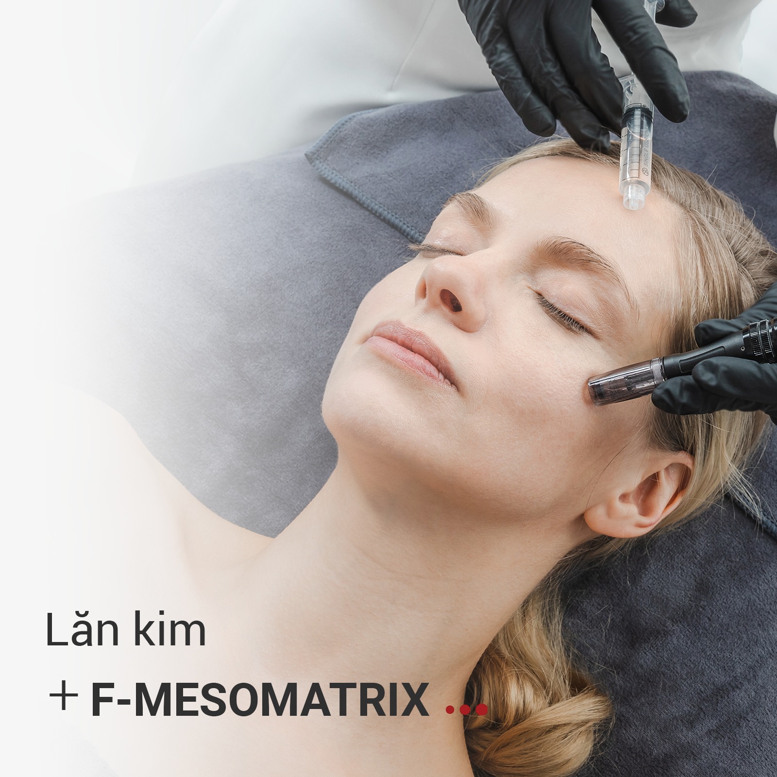 Tinh chất Fusion F-Meso Matrix điều trị đầy sẹo lõm, sẹo rỗ