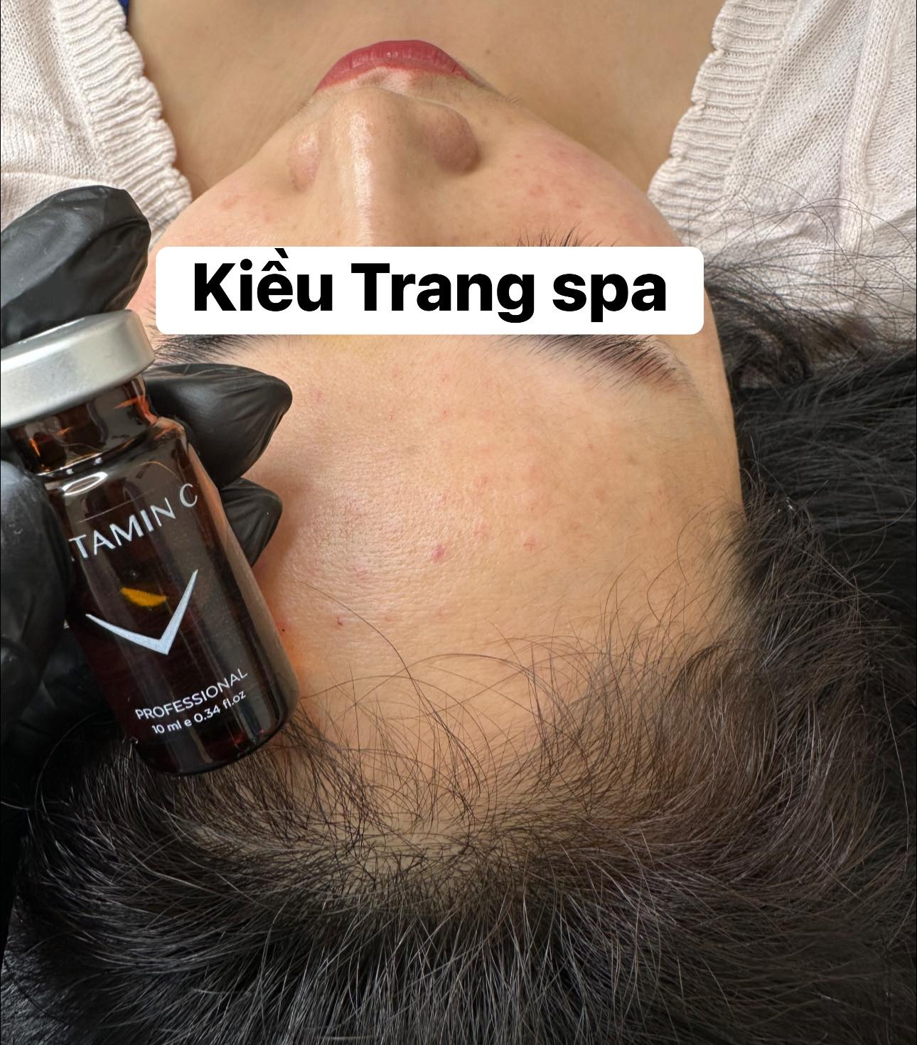Tinh chất Fusion F-Vitamin C trị thâm và trắng sáng da Fusion Mesotherapy