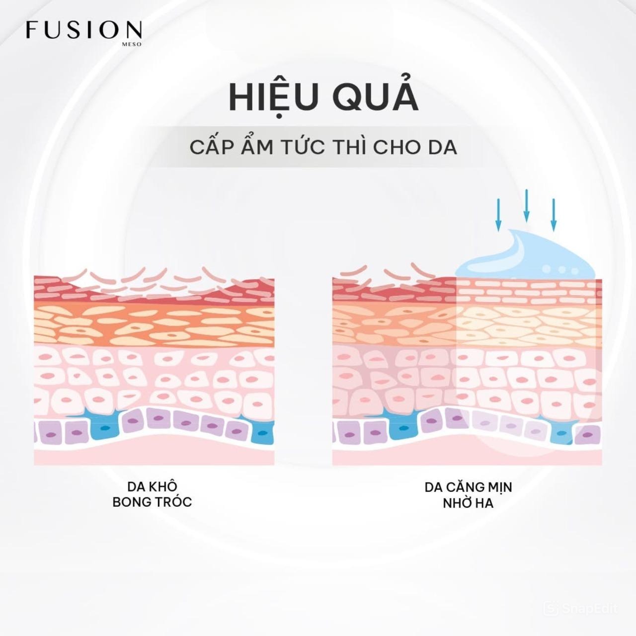 Tinh Chất Meso Căng Bóng, Cấp Ẩm Và Trẻ Hóa Da Fusion F-HA 10ml