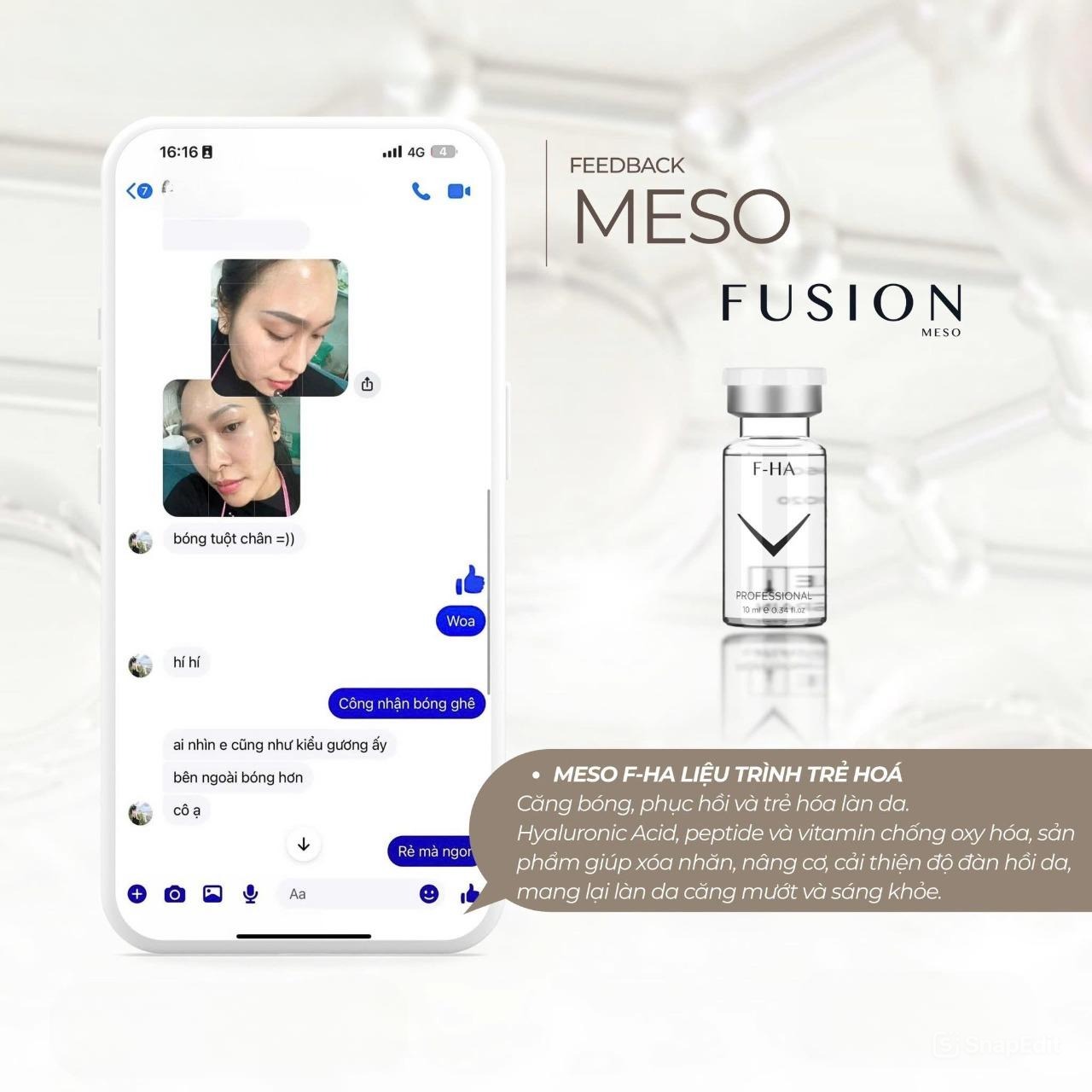 Tinh Chất Meso Căng Bóng, Cấp Ẩm Và Trẻ Hóa Da Fusion F-HA 10ml