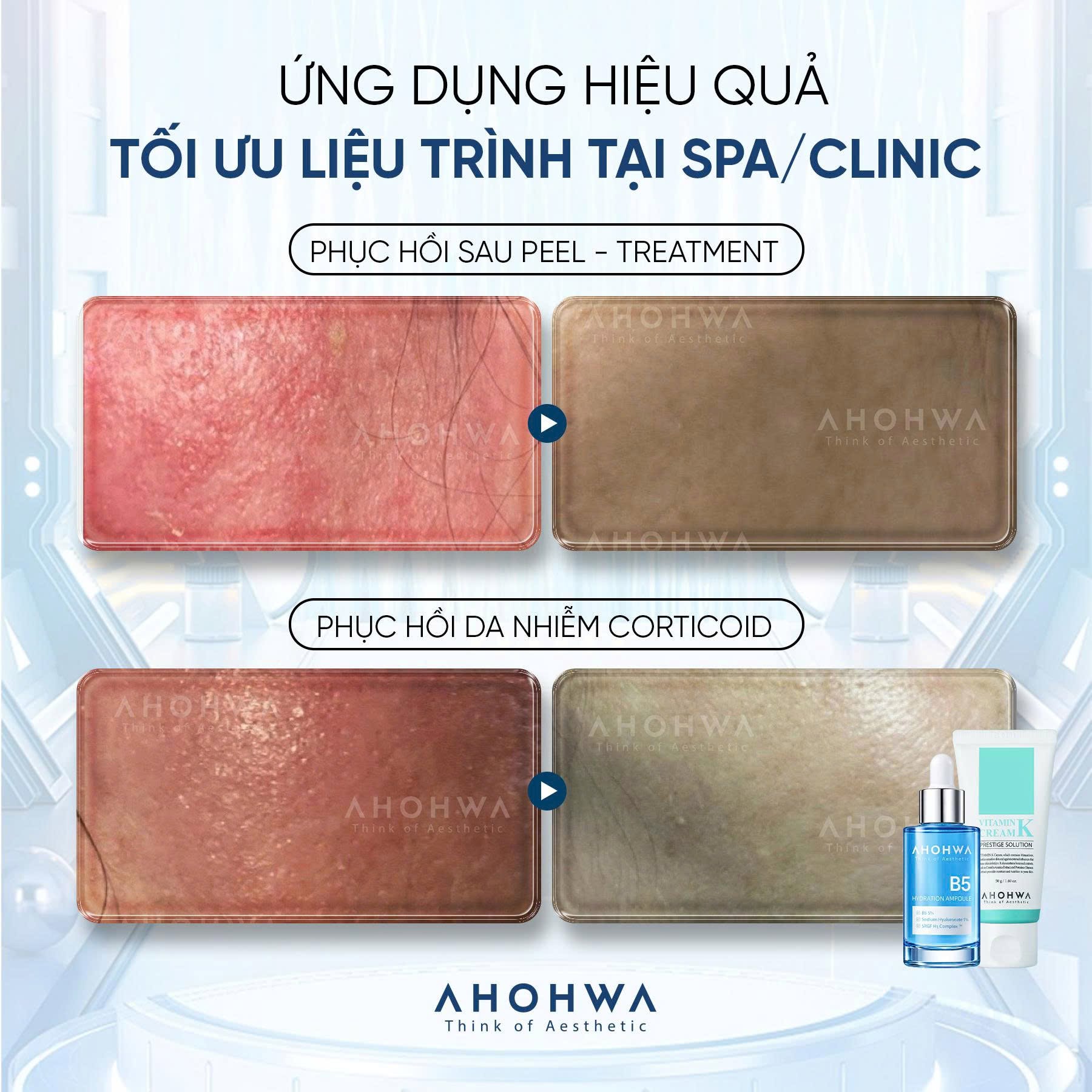 Tinh chất ampoule B5 cấp ẩm phục hồi da Ahohwa Hydration Ampoule B5