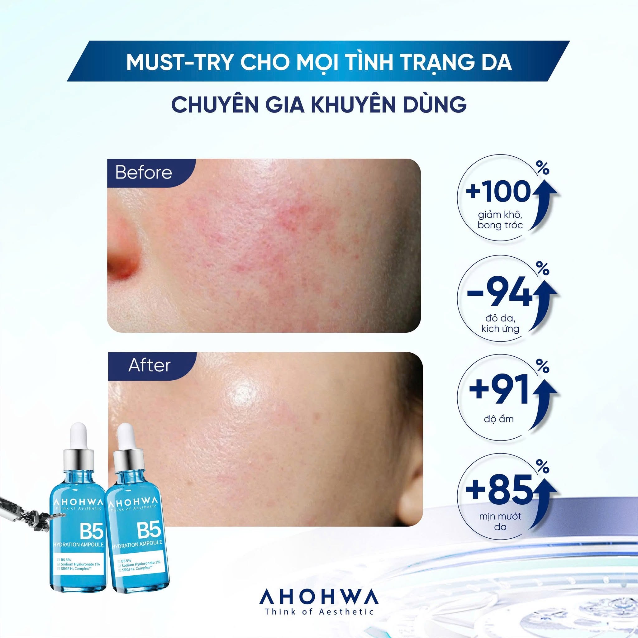 Tinh chất ampoule B5 cấp ẩm phục hồi da Ahohwa Hydration Ampoule B5