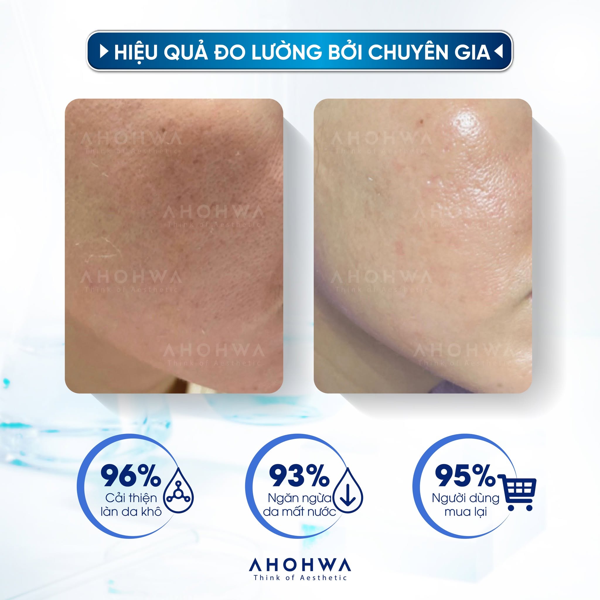 Tinh chất cấp ẩm chuyên sâu Ahohwa After Solution Inten-Cure Hydro Complex Ampoule