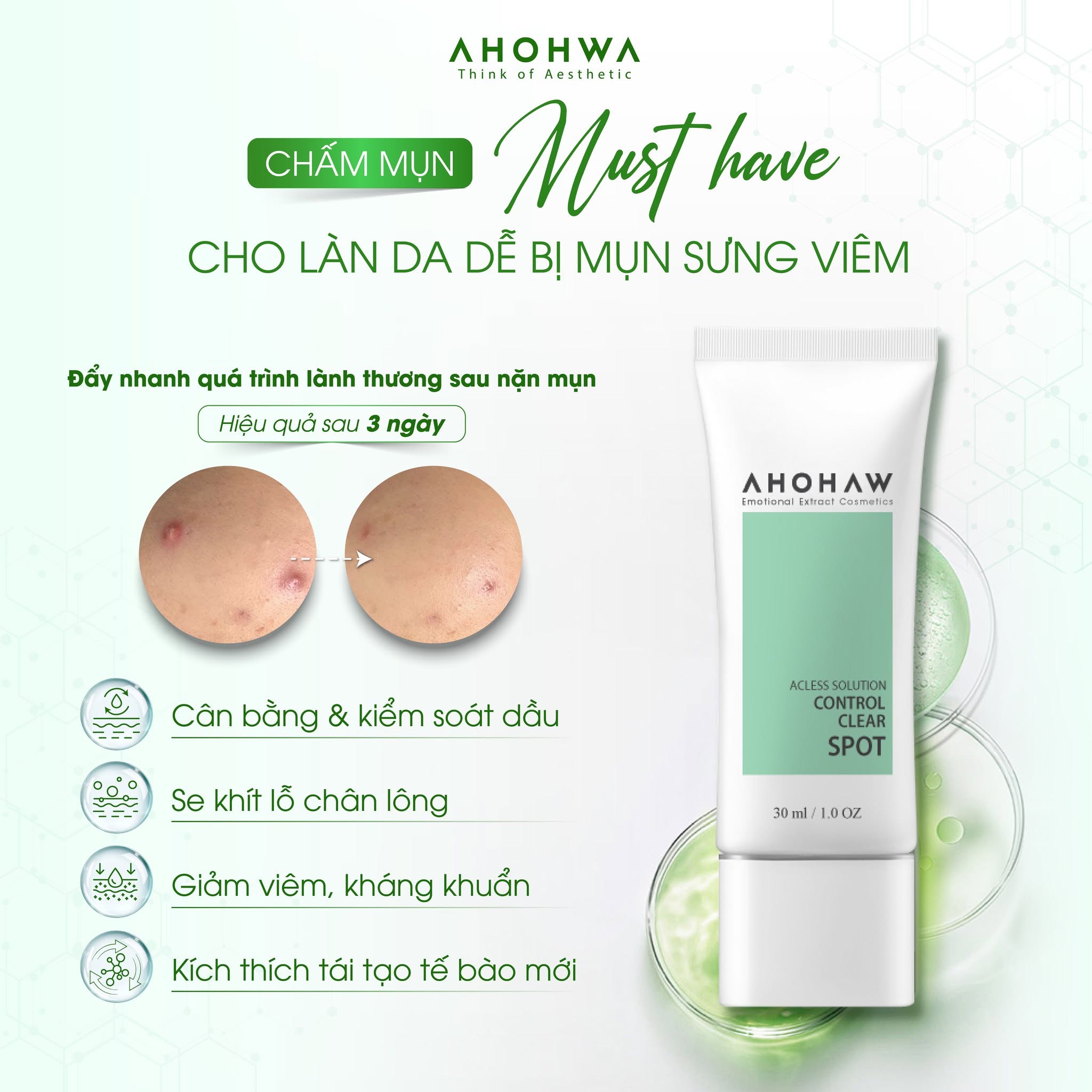 Tinh chất chấm mụn giảm viêm Ahohwa Acless Solution Control Clear Spot