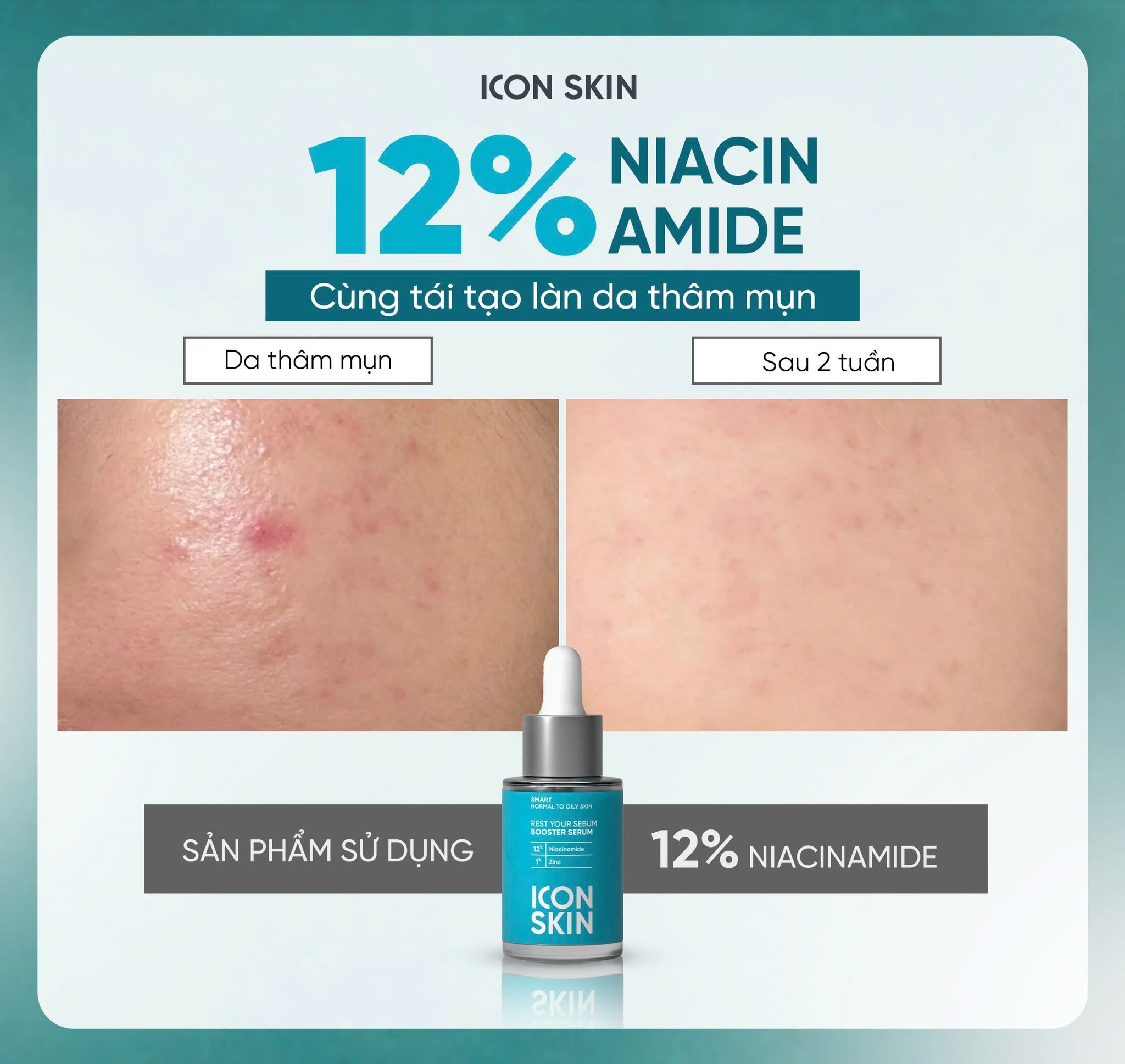 Tinh chất chuyên sâu cho da dầu và mụn Icon Skin Rest Your Sebum Booster Serum 12% Niacinamide