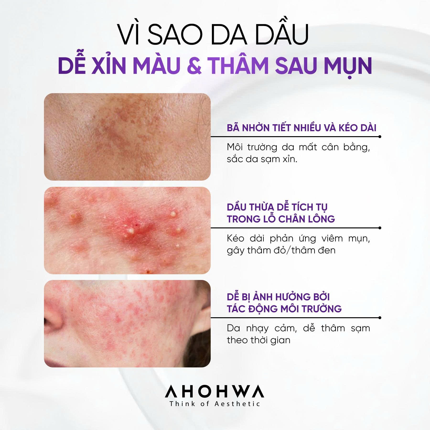 Tinh chất dưỡng trắng se khít lỗ chân lông Ahohwa Pore Niacin 20 Ampoule