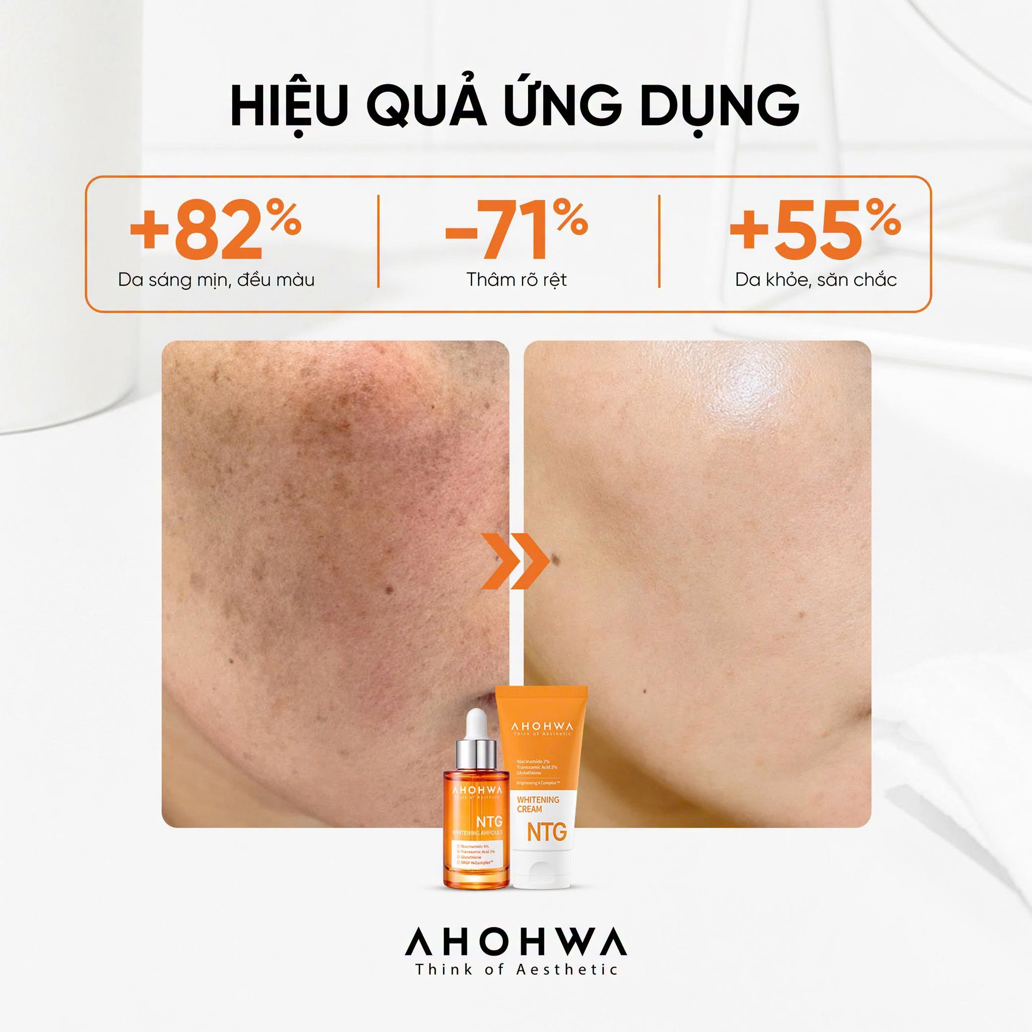 Tinh chất giảm nám đỏ dưỡng trắng kiểm soát tăng sắc tố Ahohwa Whitening Ampoule NTG