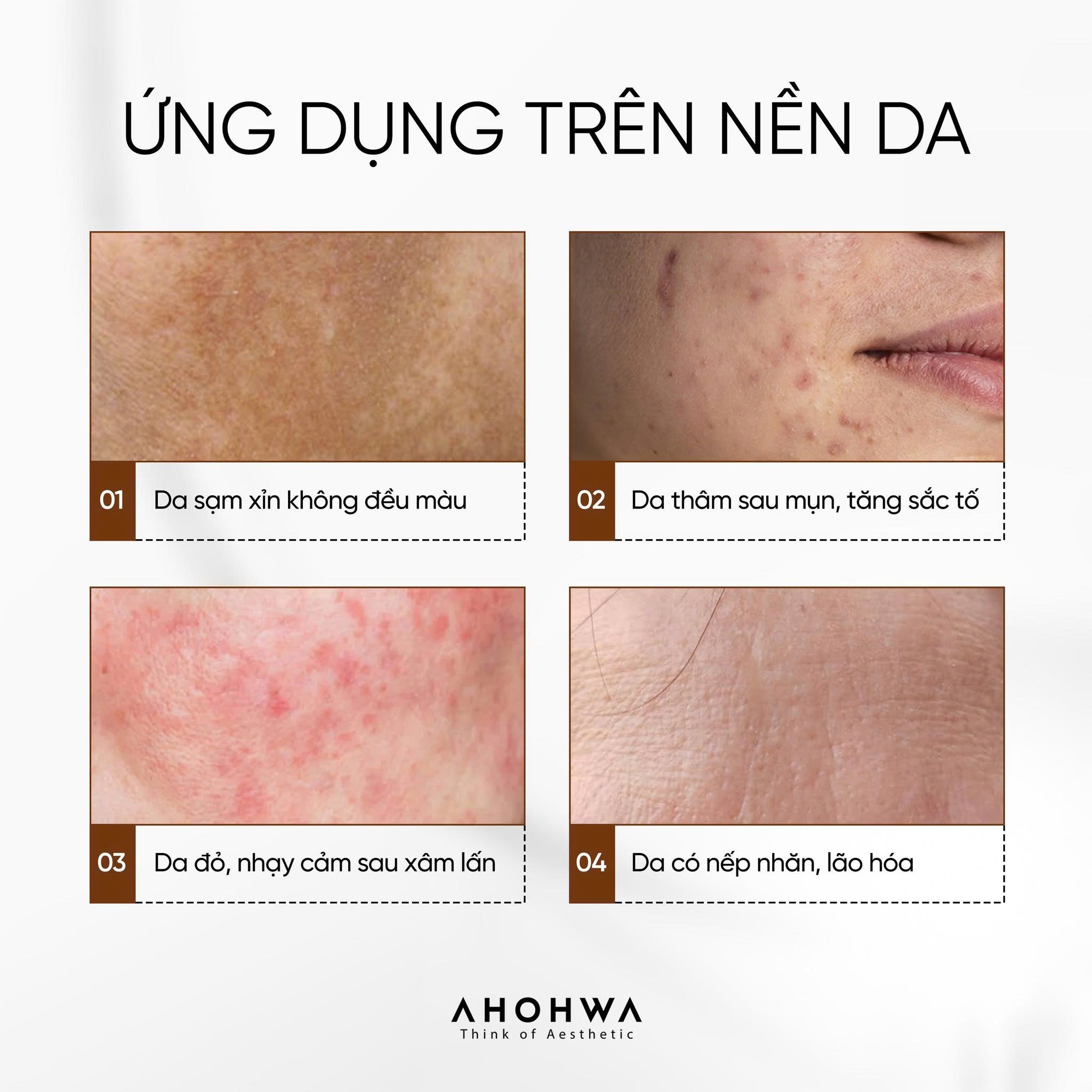 Tinh chất giảm nám đỏ dưỡng trắng kiểm soát tăng sắc tố Ahohwa Whitening Ampoule NTG