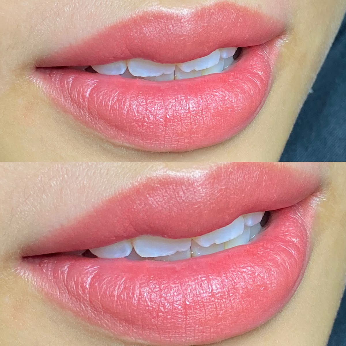 Tinh chất hồng môi Puri Lips - Hộp 1ml
