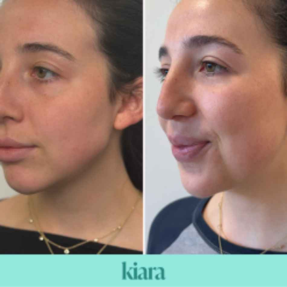 Tinh chất phục hồi da, căng bóng và trẻ hóa BAP Kiara