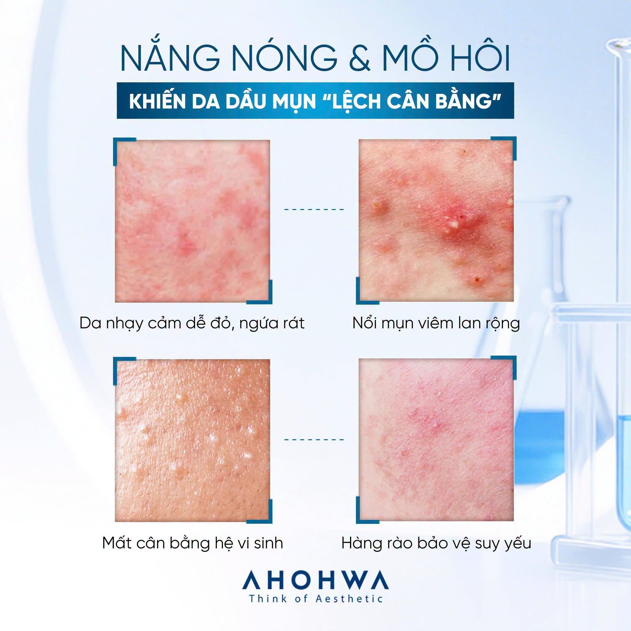 Tinh chất phục hồi trẻ hóa tế bào sinh học Ahohwa Elazulene Peptablue Calming Ampoule