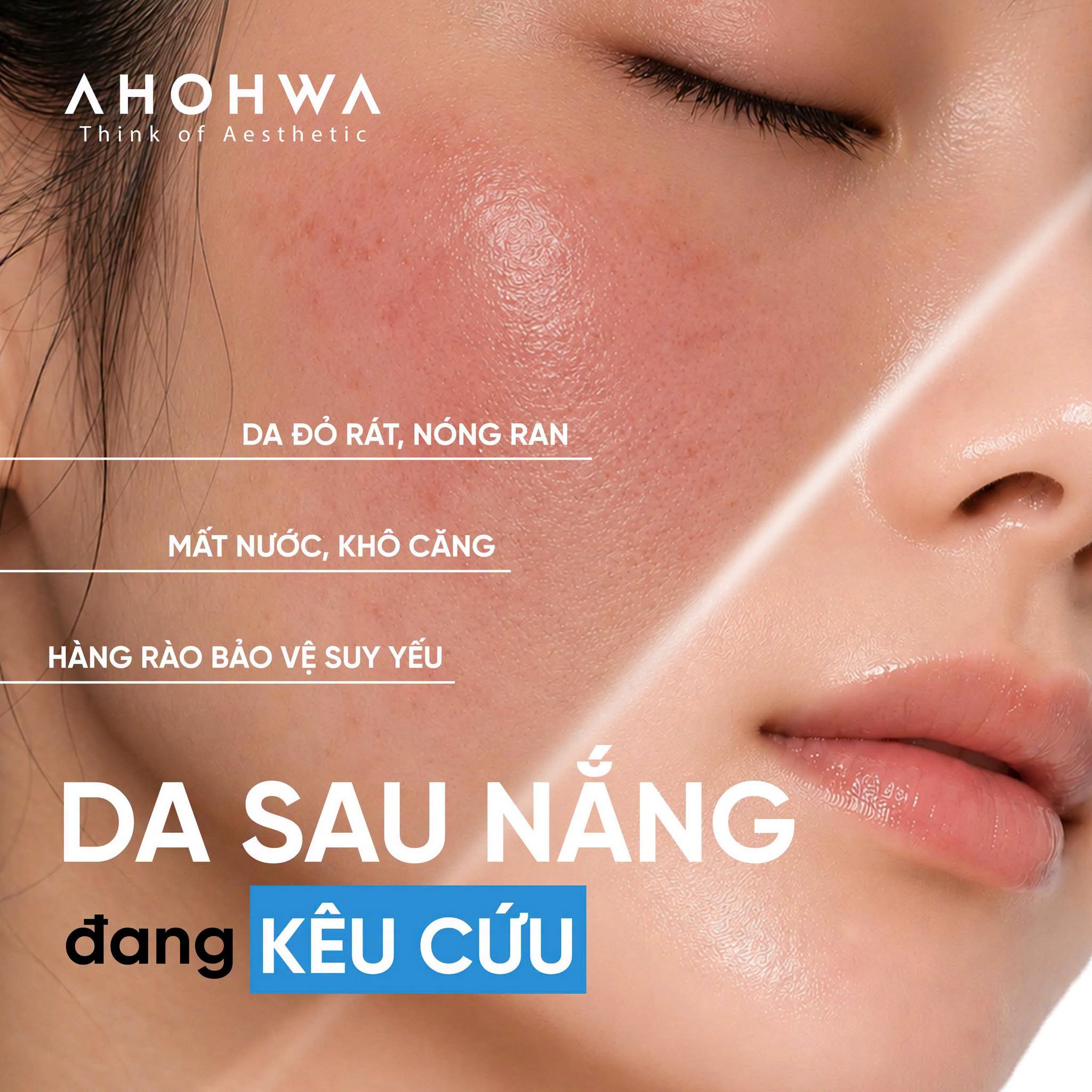 Tinh chất phục hồi trẻ hóa tế bào sinh học Ahohwa Elazulene Peptablue Calming Ampoule
