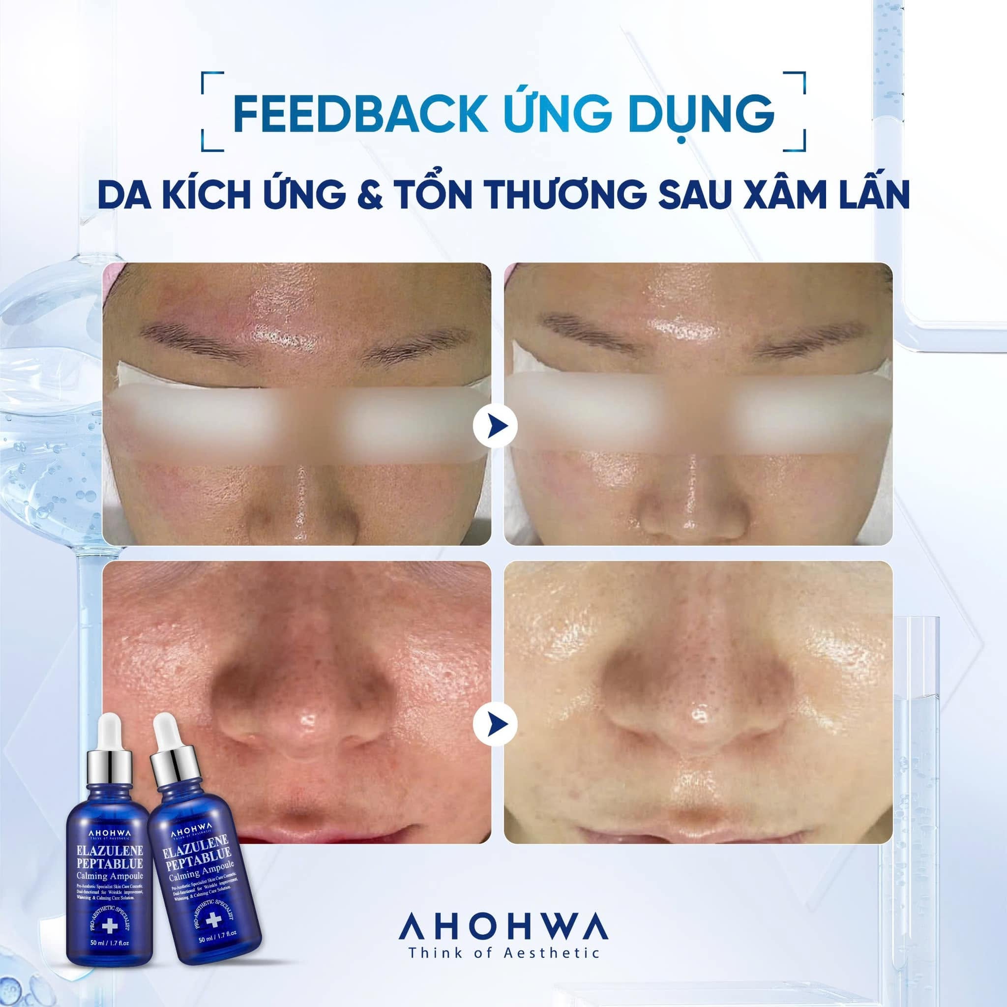 Tinh chất phục hồi trẻ hóa tế bào sinh học Ahohwa Elazulene Peptablue Calming Ampoule
