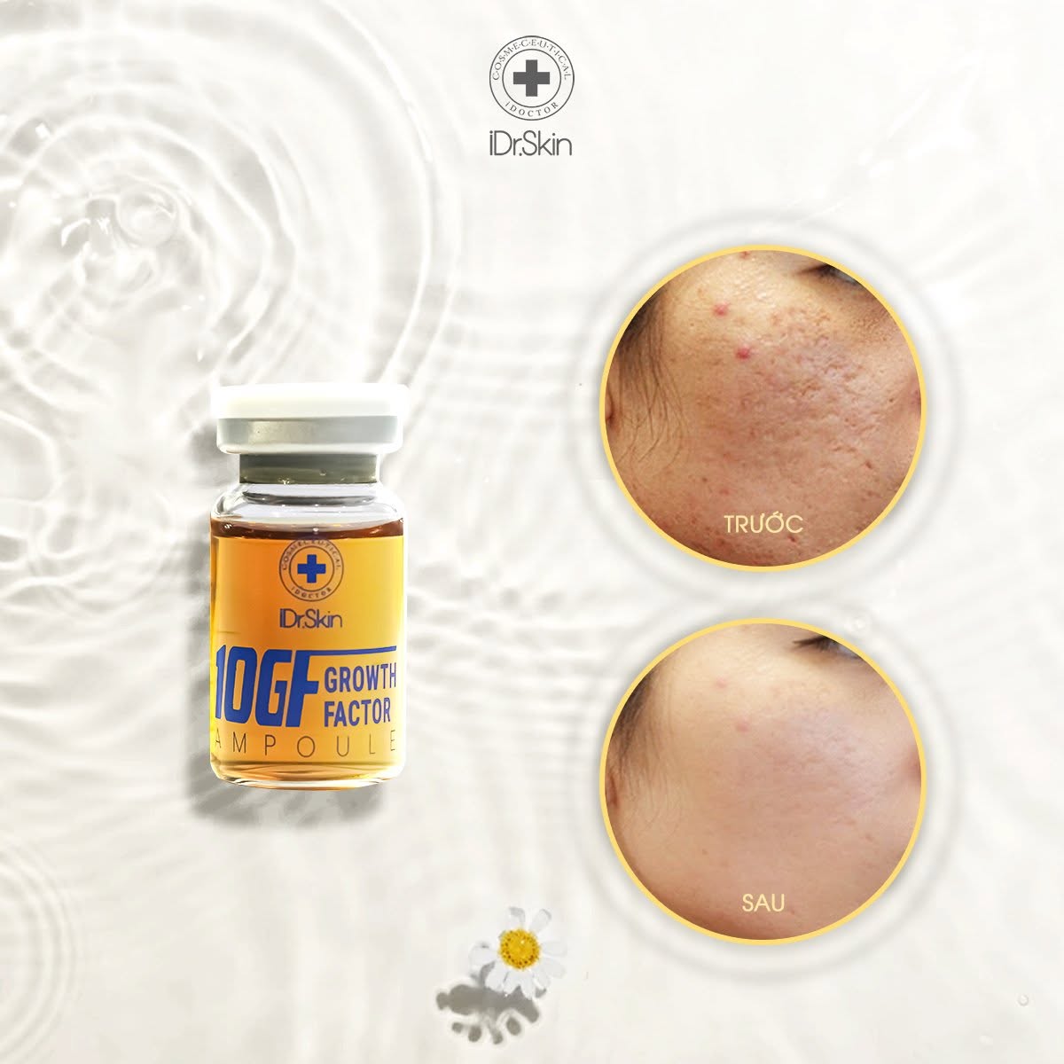 Tinh chất tế bào gốc hỗ trợ cải thiện sẹo rỗ iDr.Skin 10GF Growth Factor 10ml
