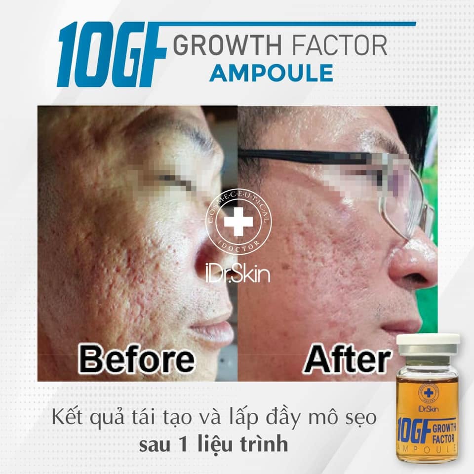 Tinh chất tế bào gốc hỗ trợ cải thiện sẹo rỗ iDr.Skin 10GF Growth Factor 10ml