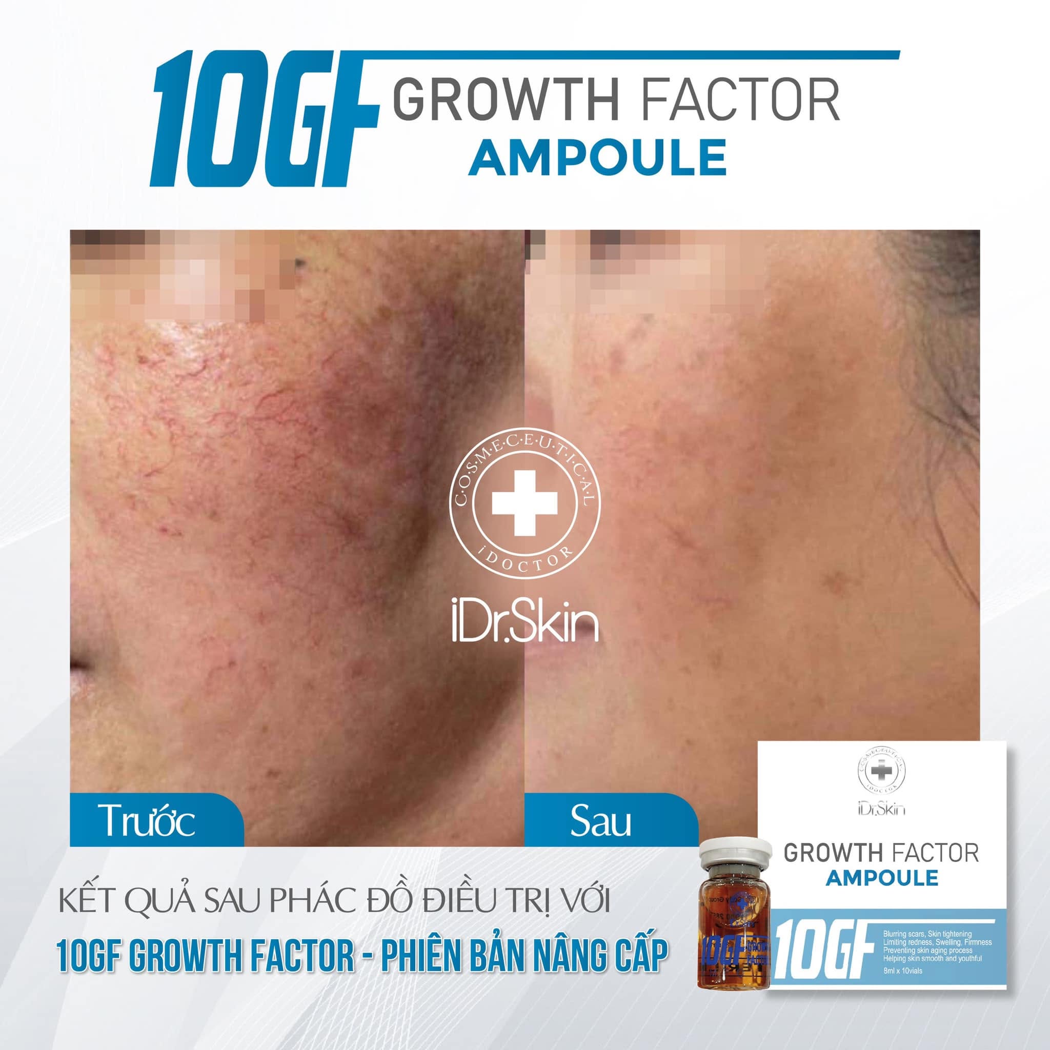 Tinh chất tế bào gốc hỗ trợ cải thiện sẹo rỗ iDr.Skin 10GF Growth Factor 10ml