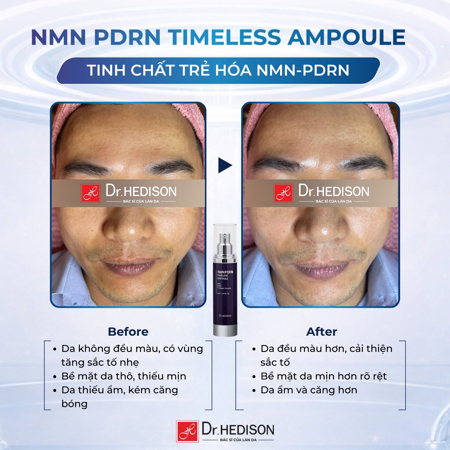 Tinh chất trẻ hóa NMN PDRN Timeless Ampoule Dr.Hedison 50ml
