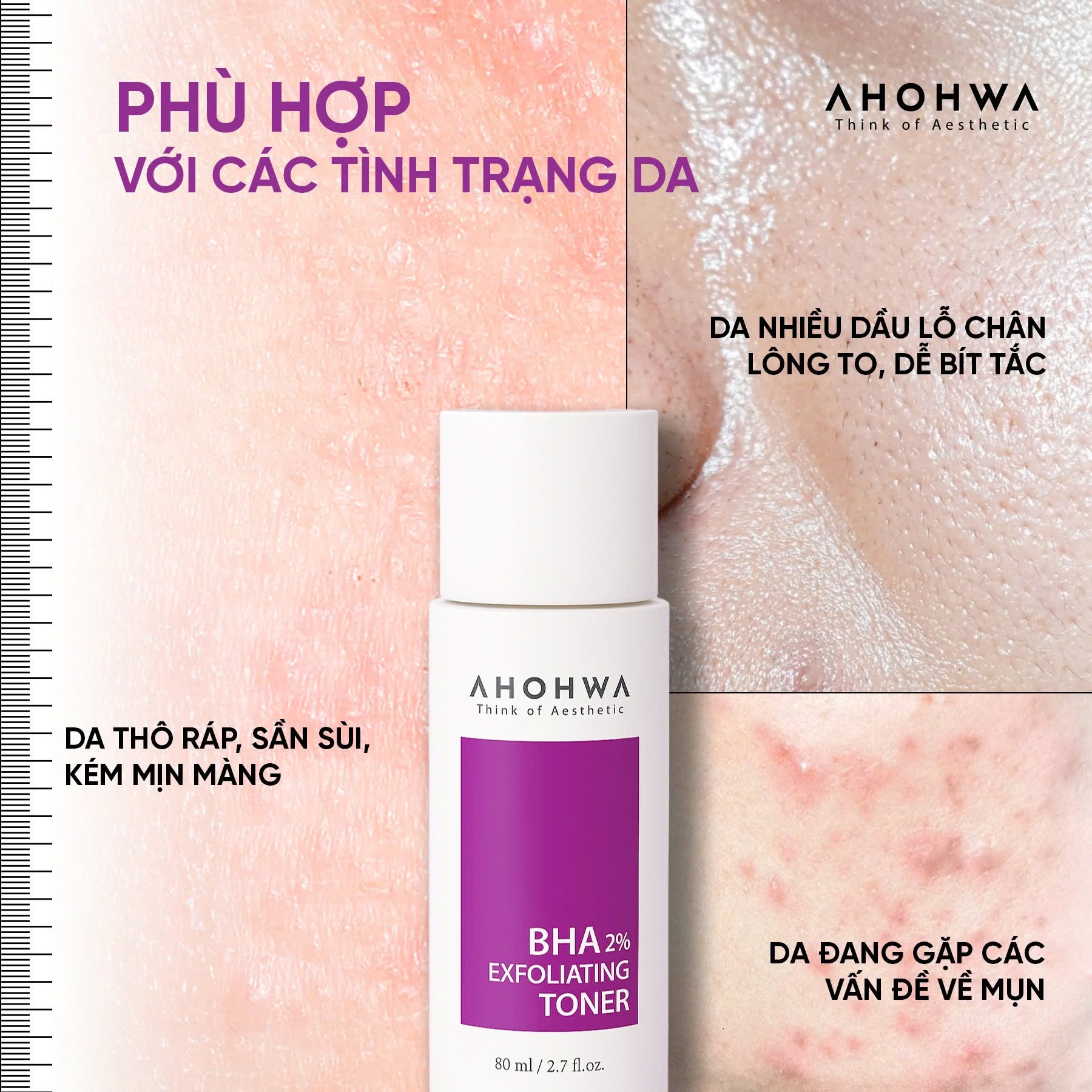 Toner hỗ trợ giảm mụn làm sạch bã nhờn thu nhỏ lỗ chân lông Ahohwa BHA 2% Exfoliating Toner