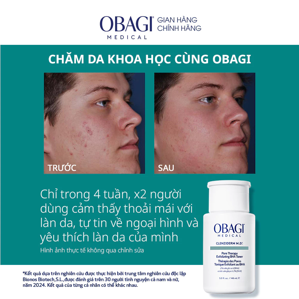 Toner tẩy da chết, ngừa mụn Obagi Clenziderm M.D. Exfoliating BHA Toner