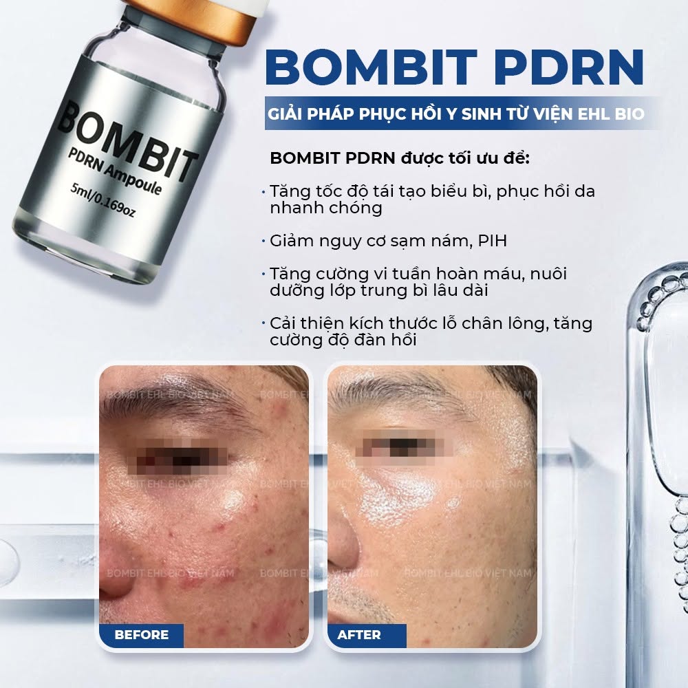 BOMBIT PDRN Meso trẻ hóa da từ tế bào gốc cá hồi 7.jpg