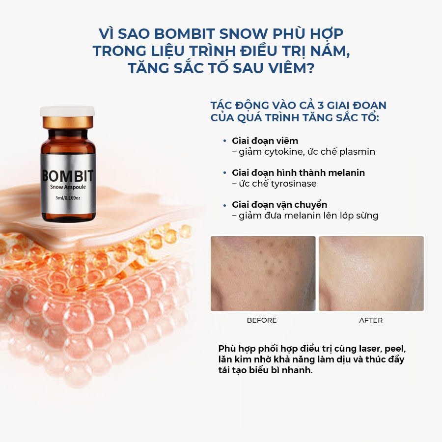 BOMBIT Snow Meso Hỗ Trợ Điều Trị Nám, Sạm Và Làm Sáng Da 7.jpg