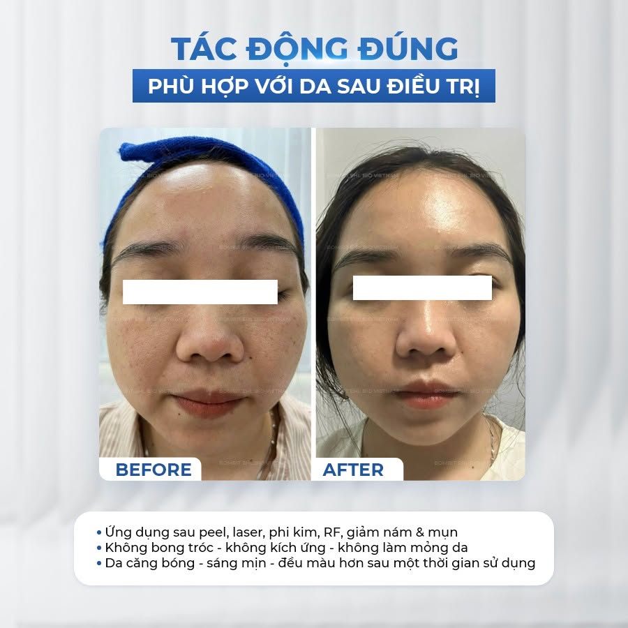 BOMBIT TOTAL SOLUTION AMPOULE 2.jpg